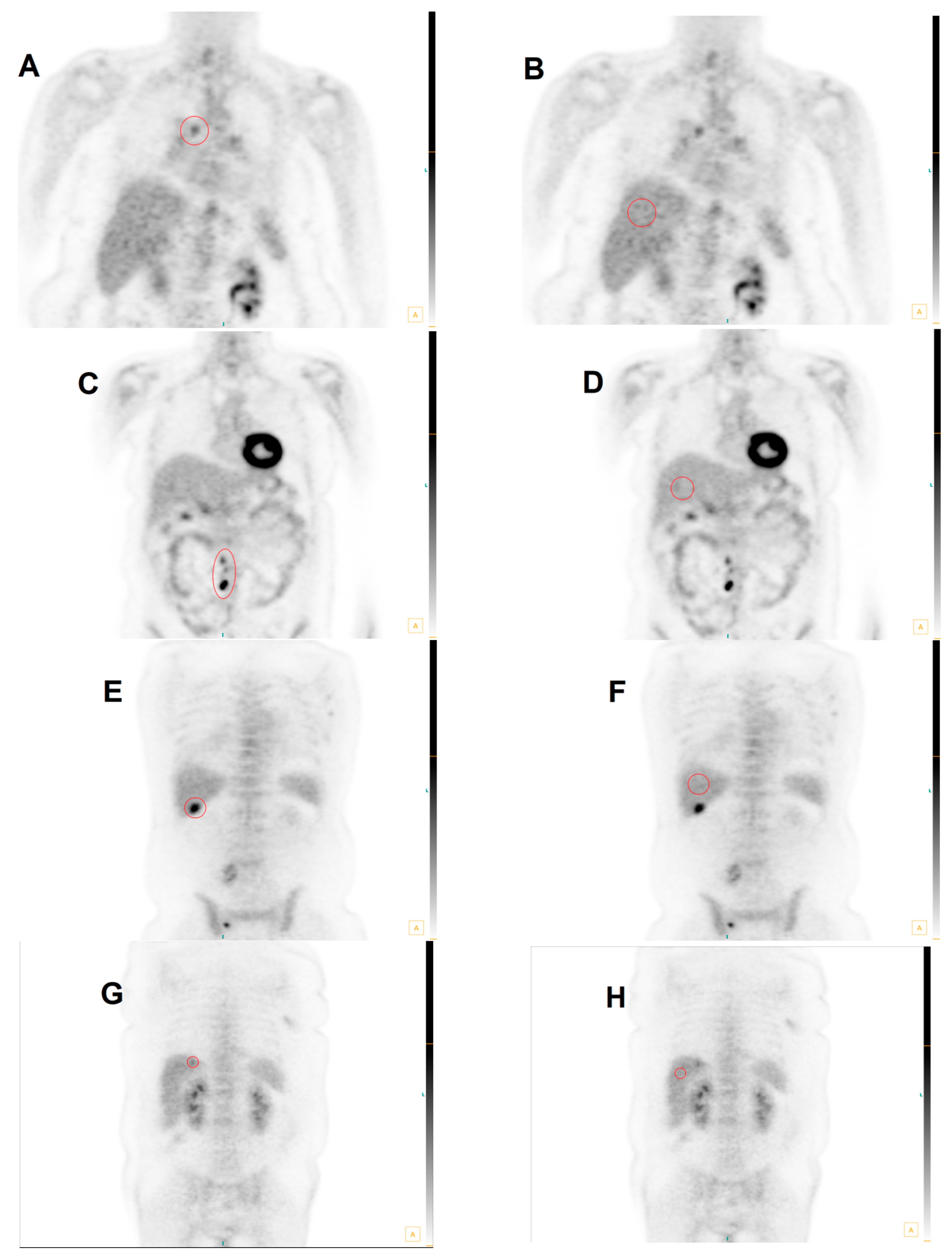 Diagnostics 13 01580 g005