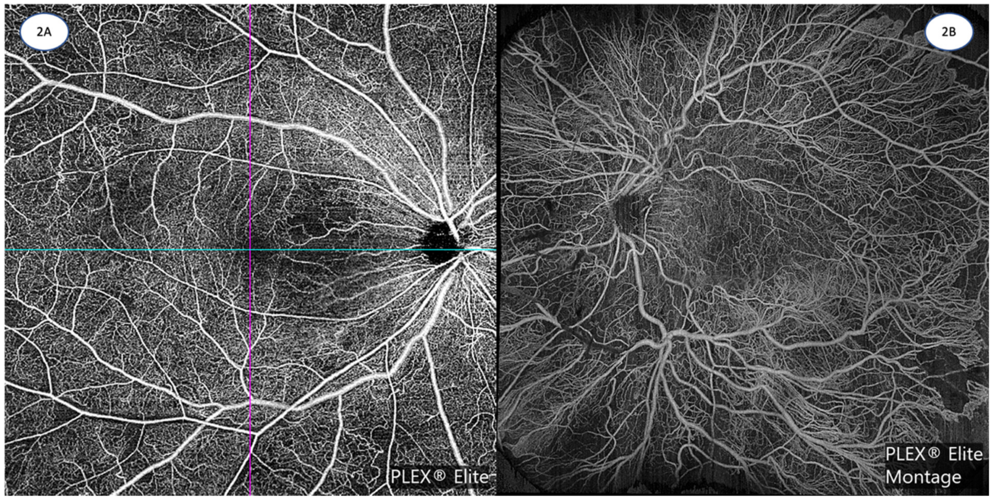 Diagnostics 13 01620 g002
