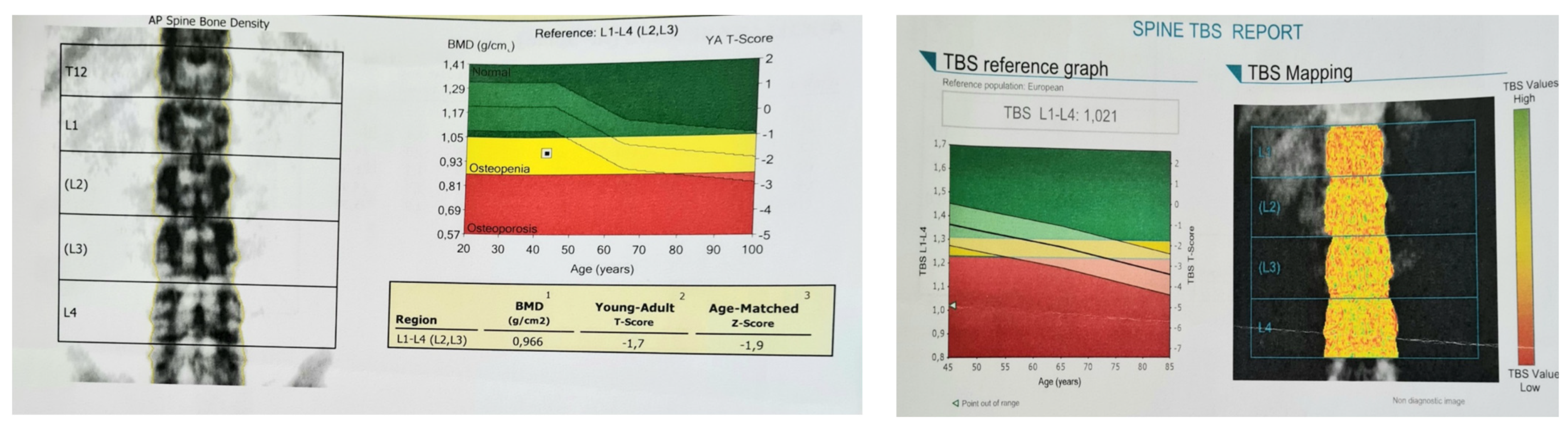 Diagnostics 13 02101 g003