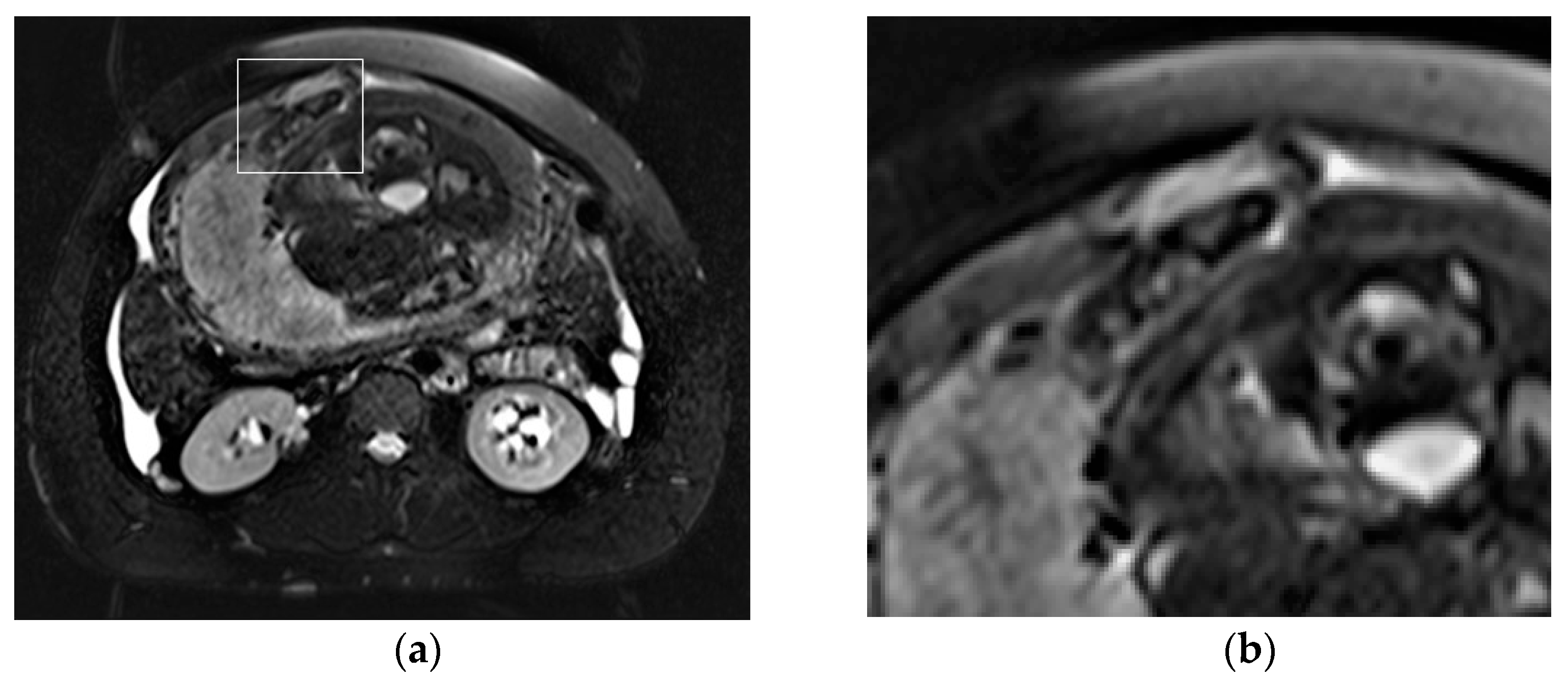 Diagnostics 13 02890 g005