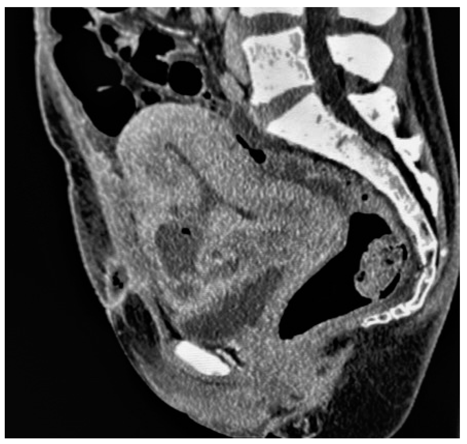 Diagnostics 13 02890 g007