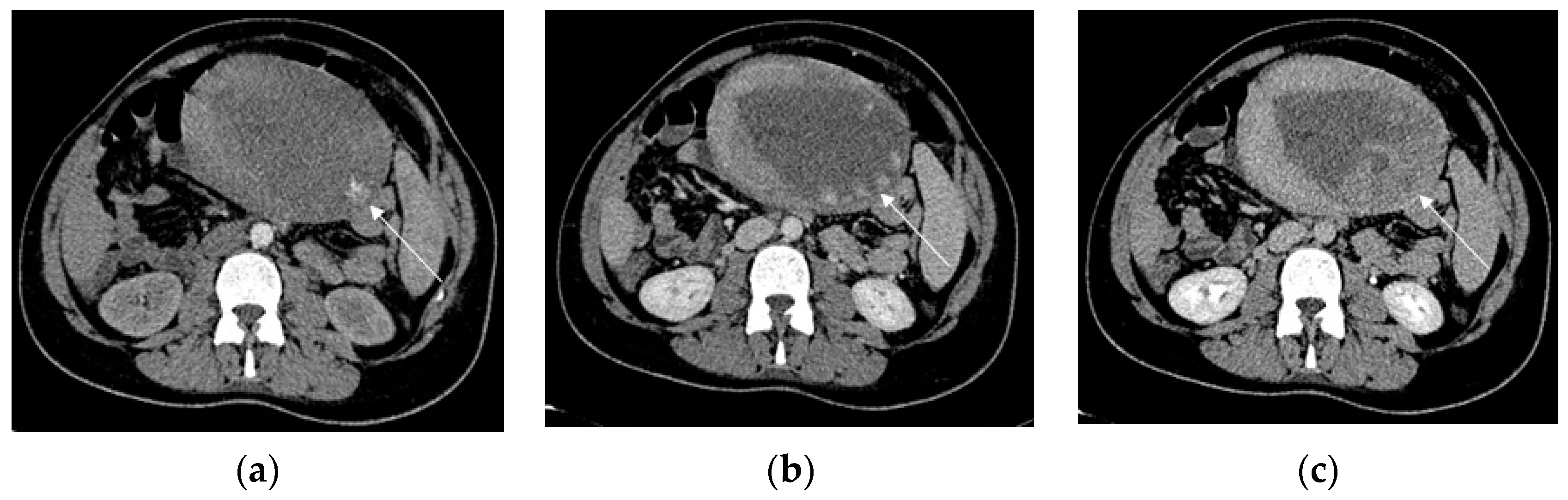 Diagnostics 13 02890 g008