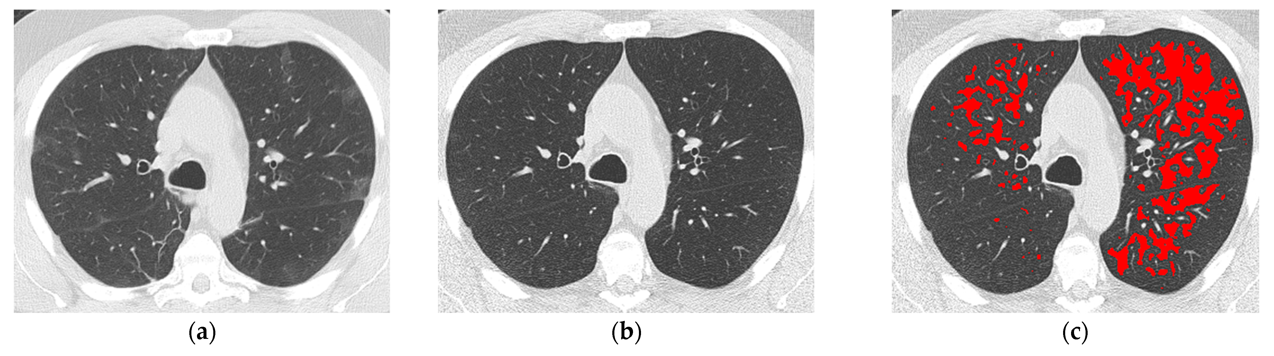 Diagnostics 13 03328 g002