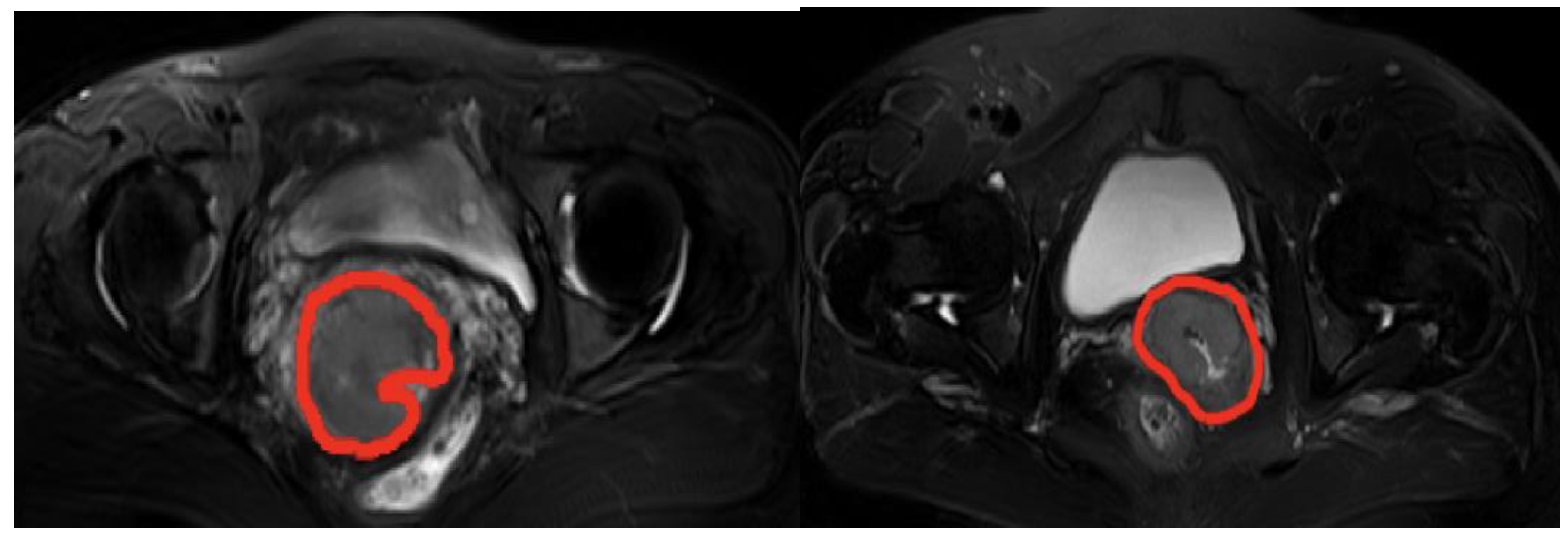Diagnostics 14 00005 g001