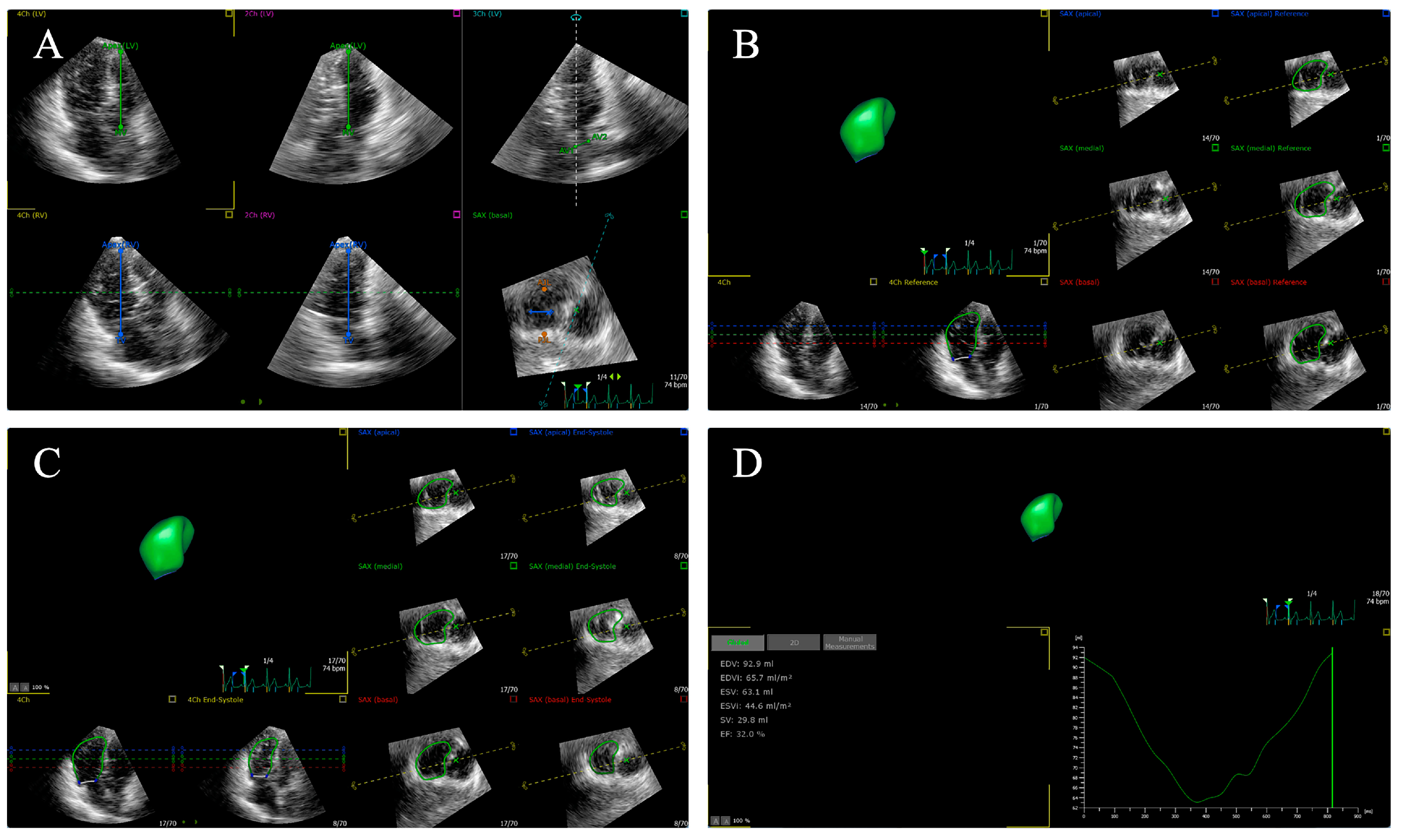 Diagnostics 14 00088 g003