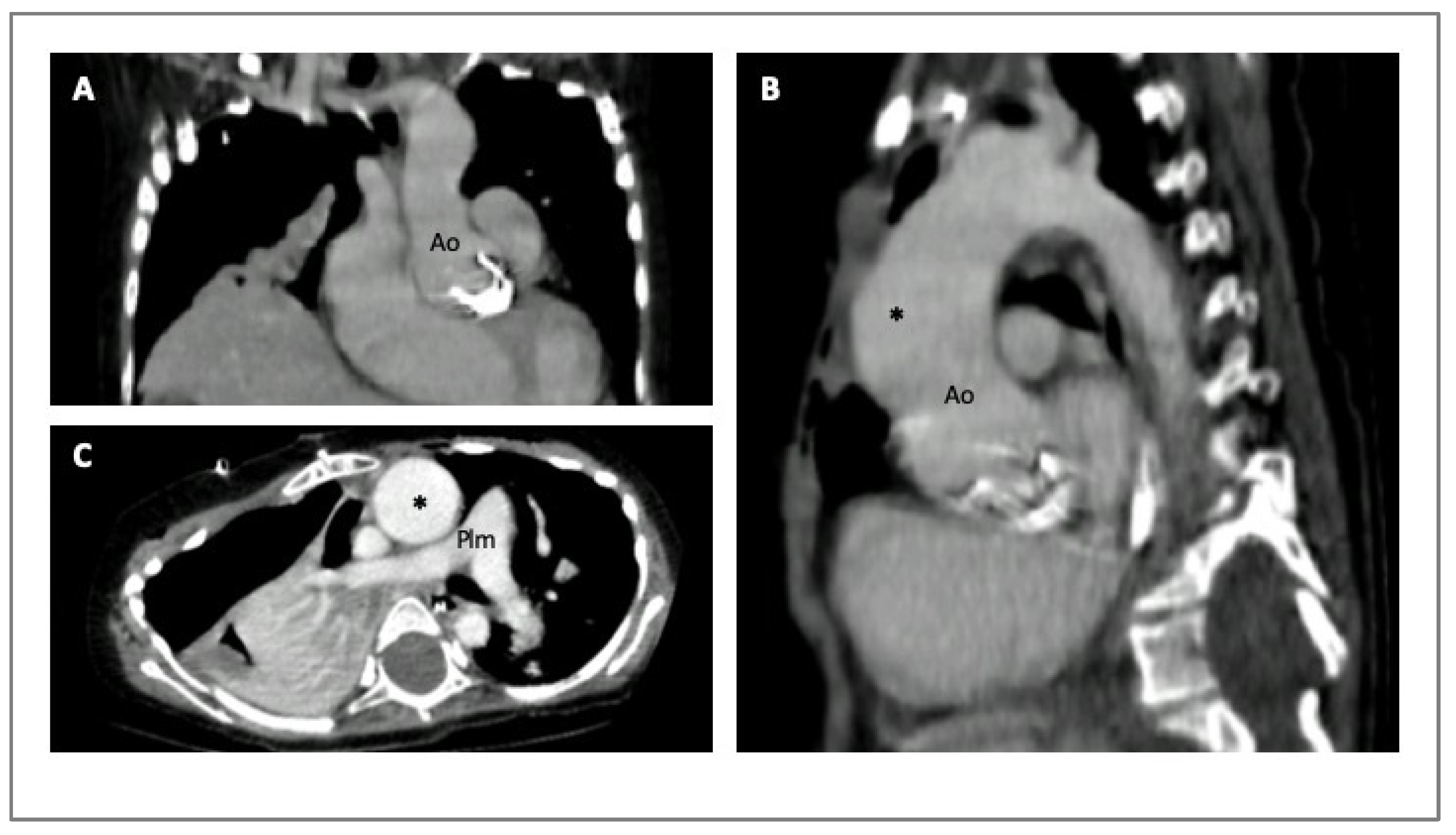 Diagnostics 14 00112 g003