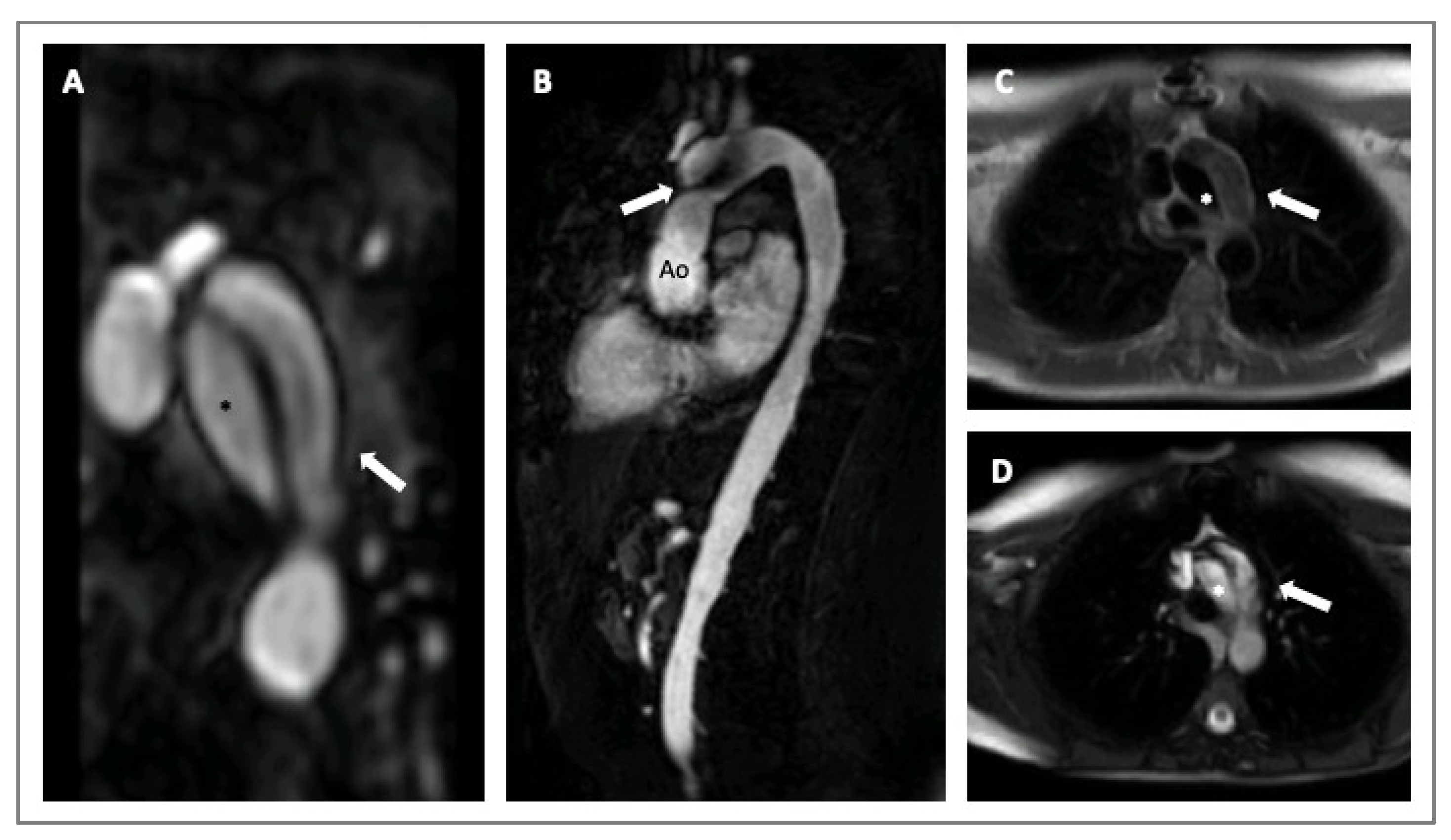 Diagnostics 14 00112 g004