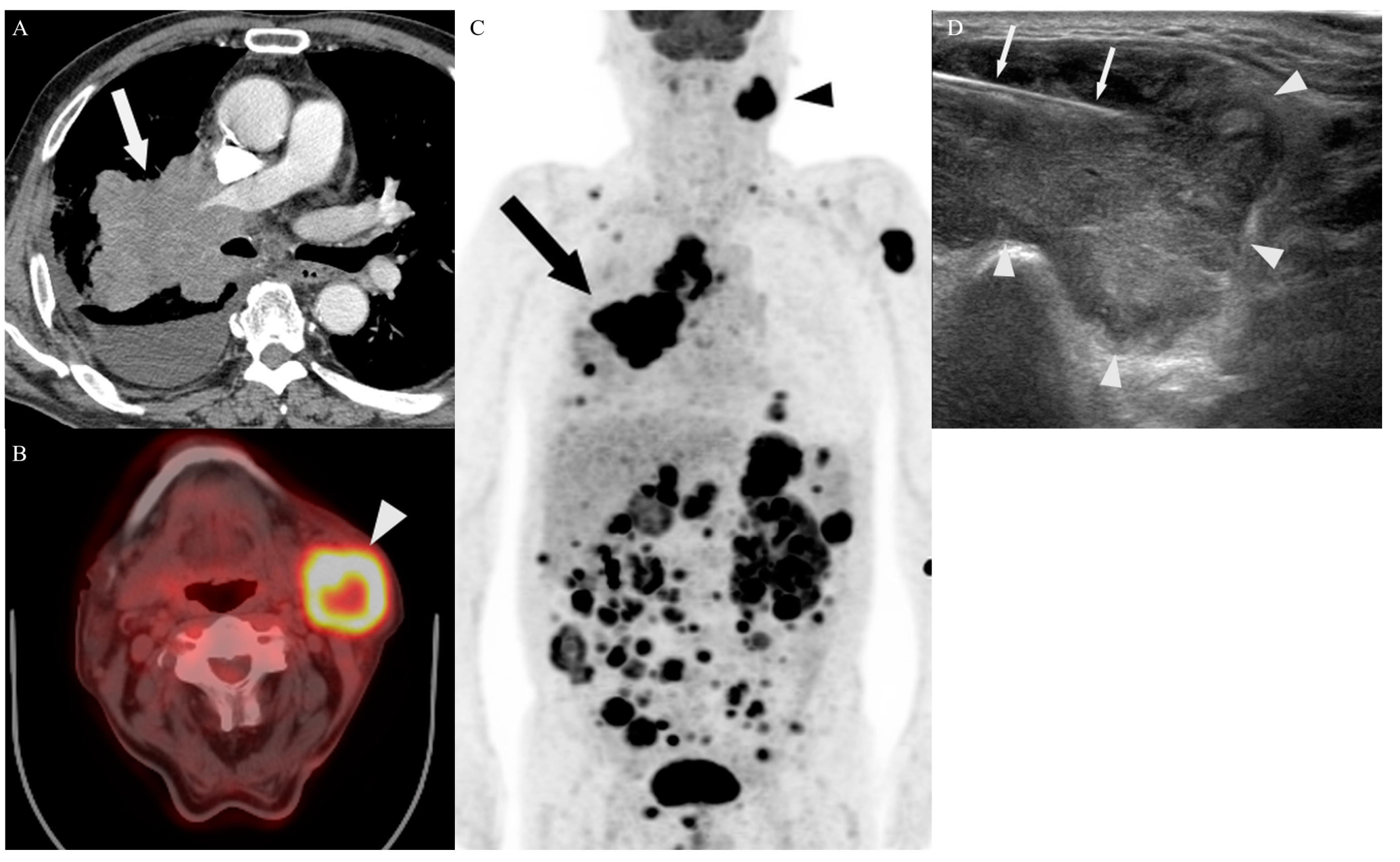 Diagnostics 14 00153 g004