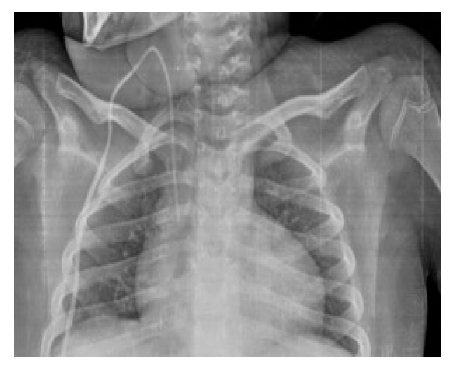 Diagnostics 14 00157 g005 Diagnostics 14 00157 g005