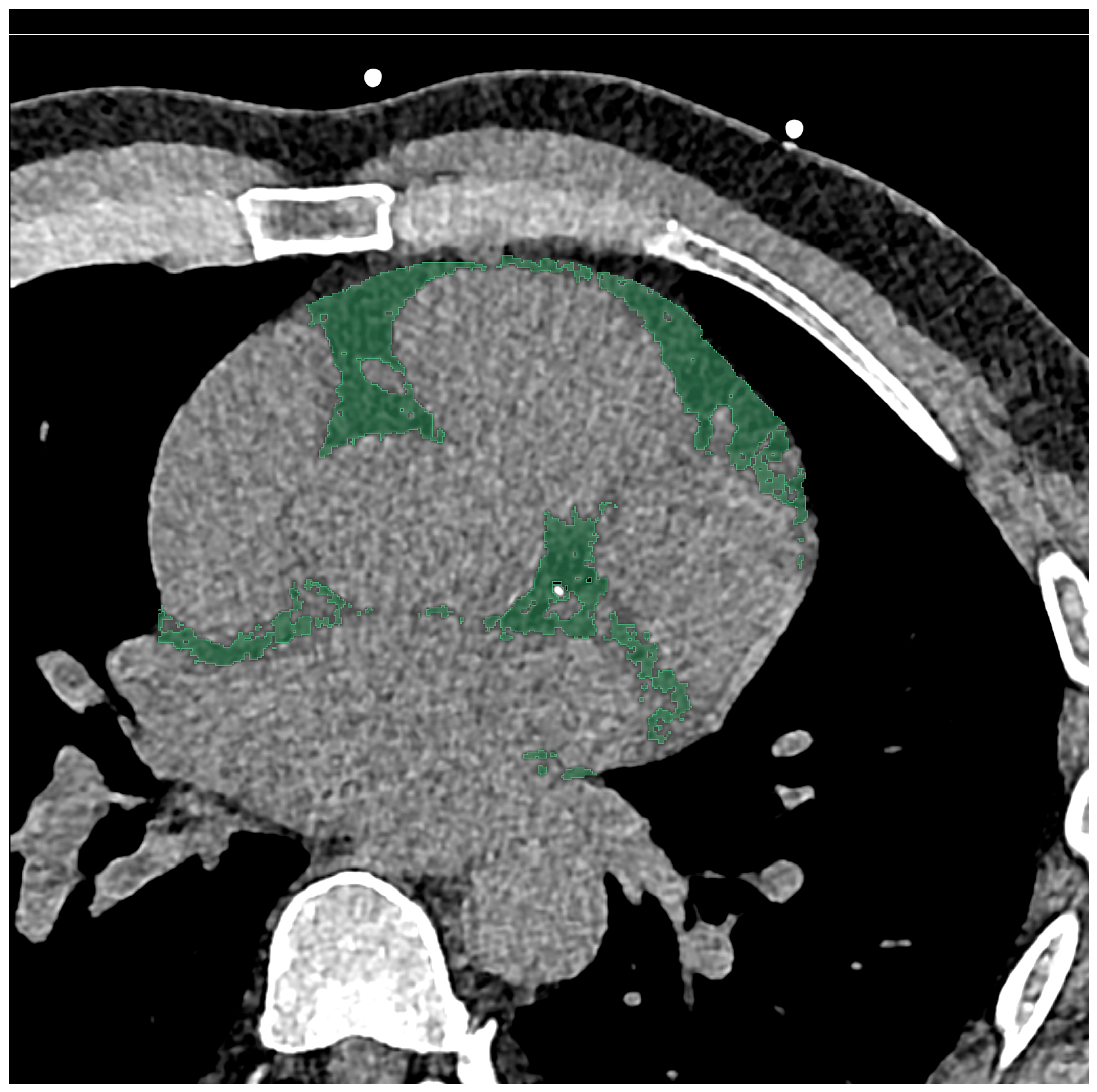 Diagnostics 14 00277 g001