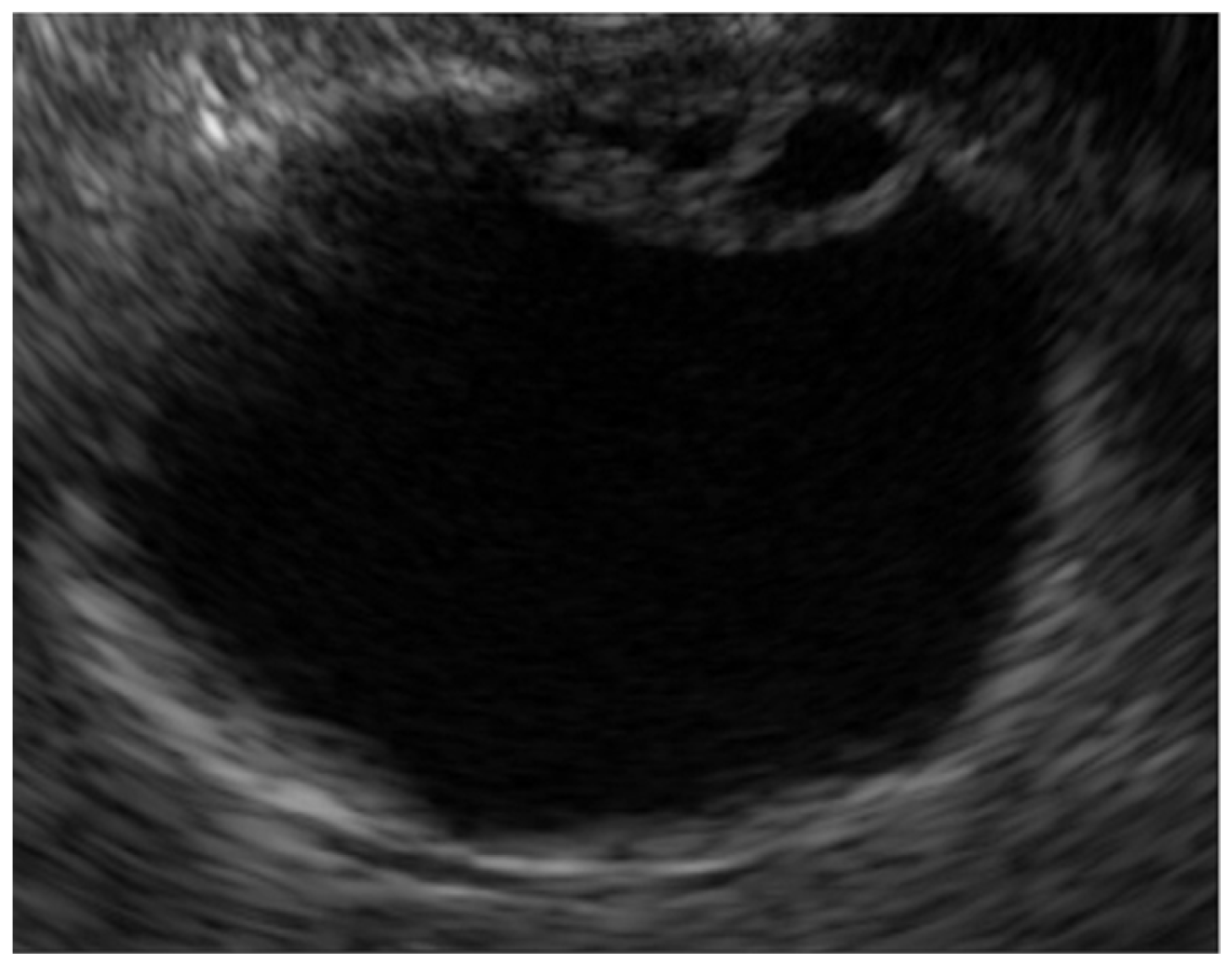 Diagnostics 14 00374 g001