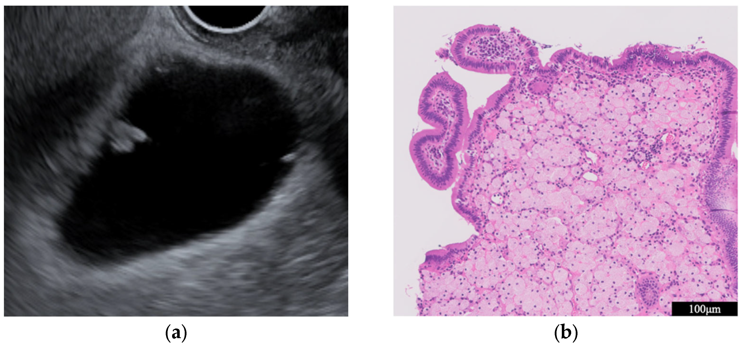 Diagnostics 14 00374 g005