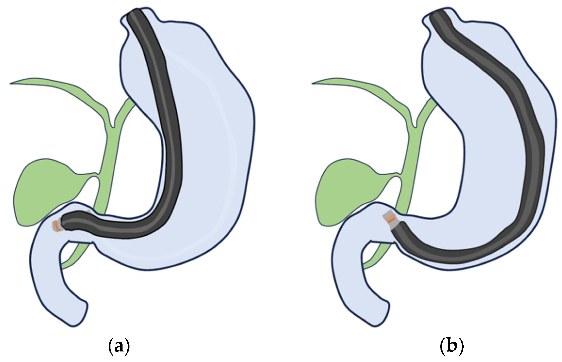 Diagnostics 14 00374 g007