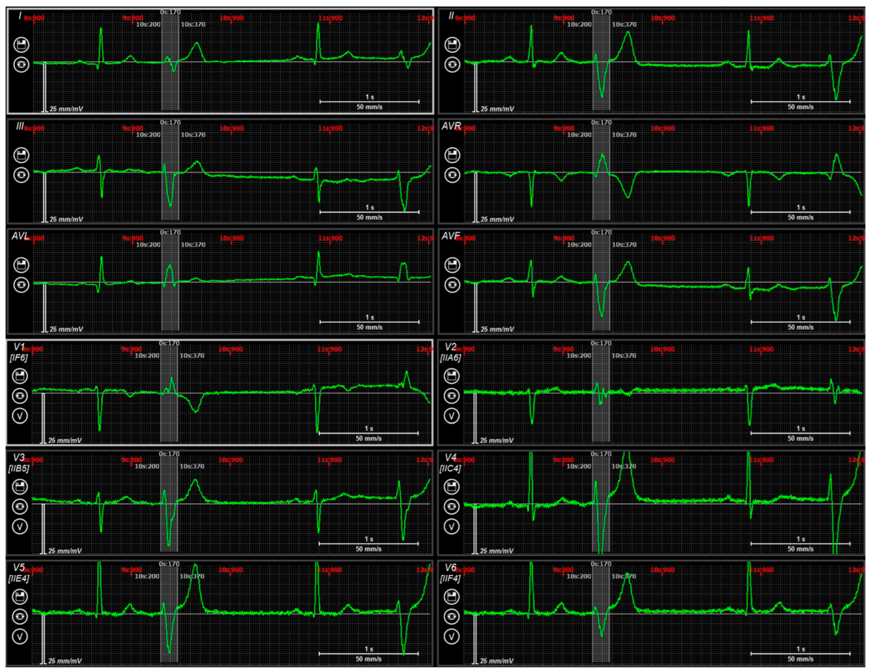 Diagnostics 14 00622 g006