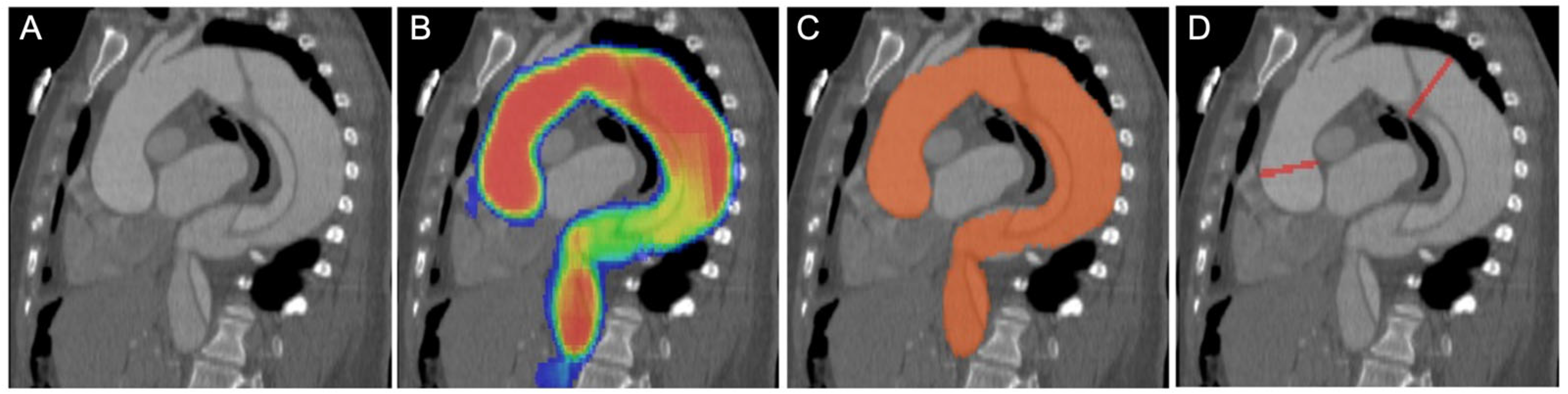 Diagnostics 14 00866 g001