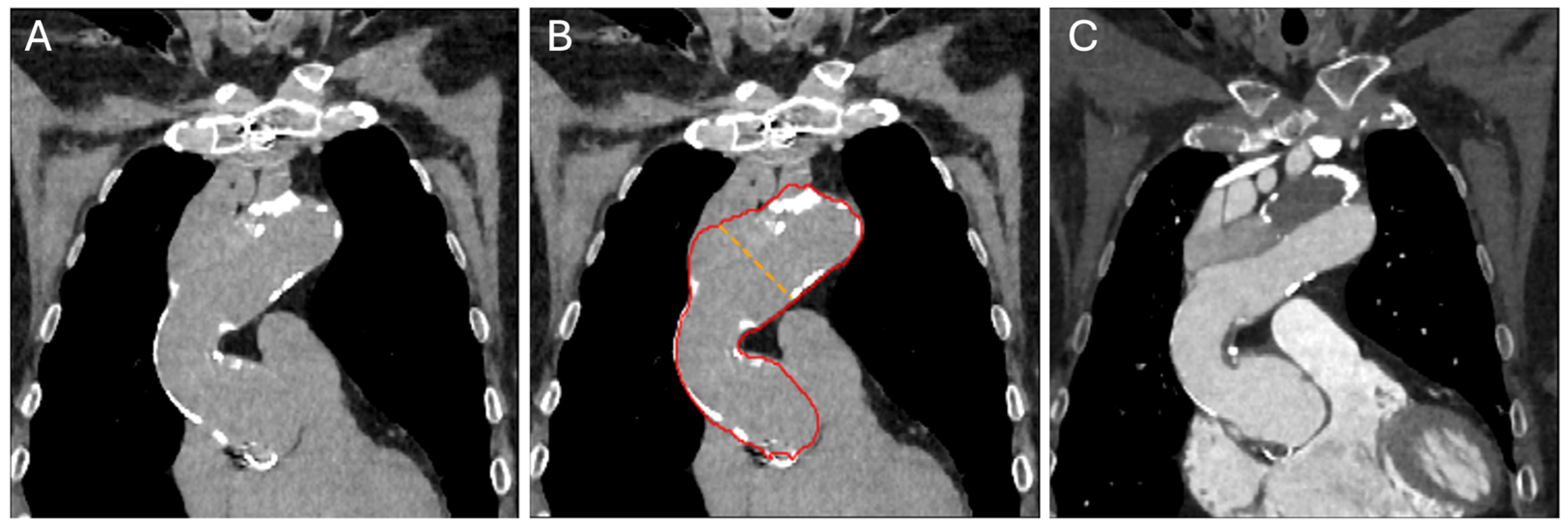 Diagnostics 14 00866 g006