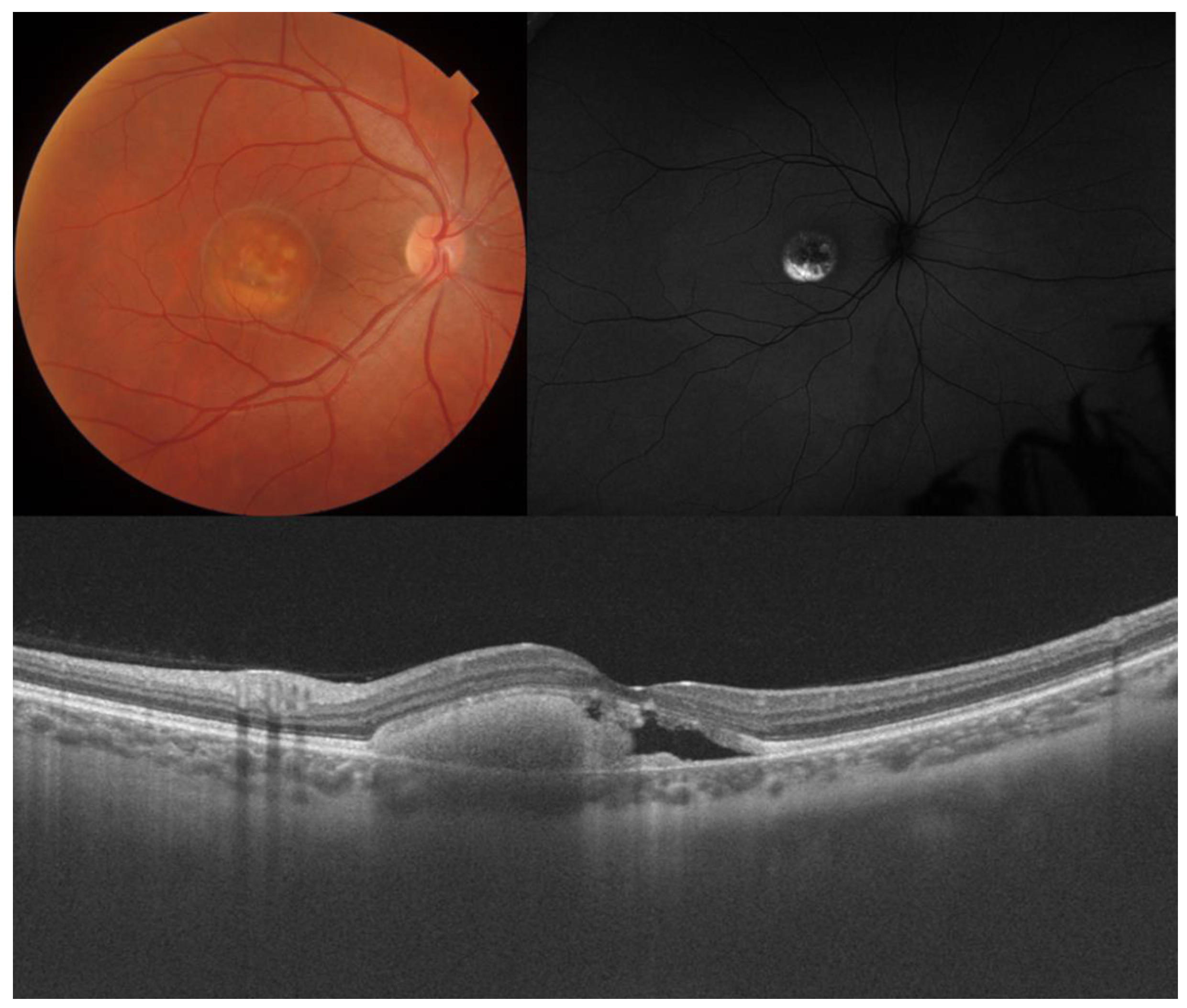 Diagnostics 14 00878 g005