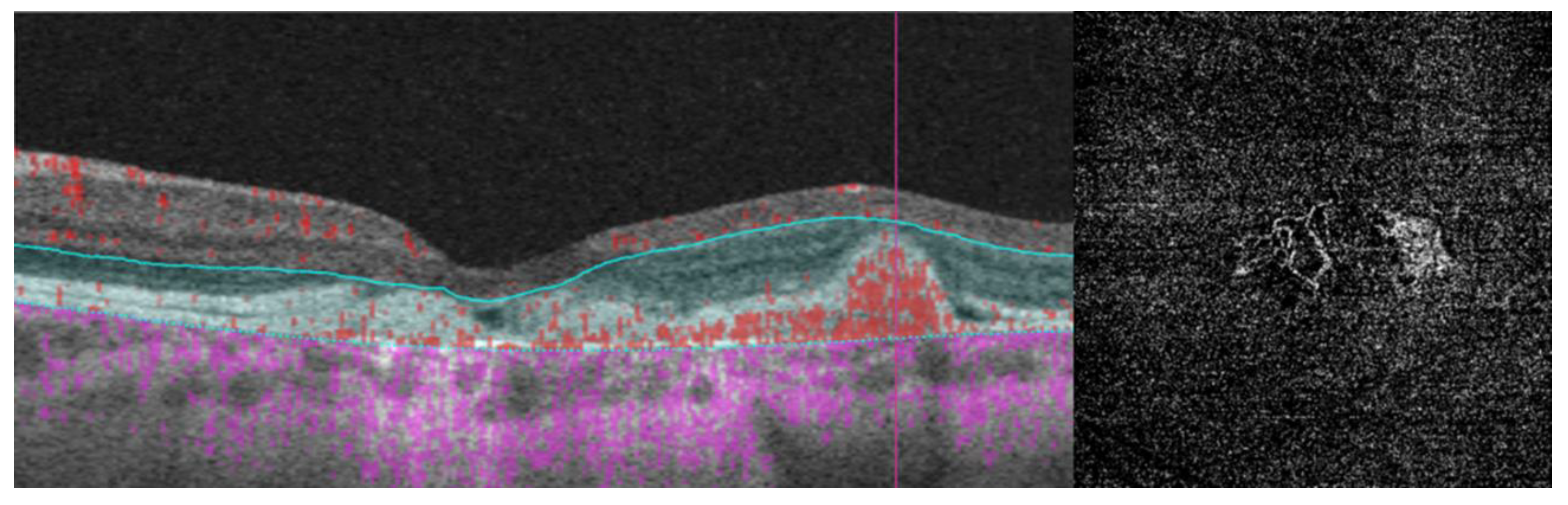 Diagnostics 14 00878 g006
