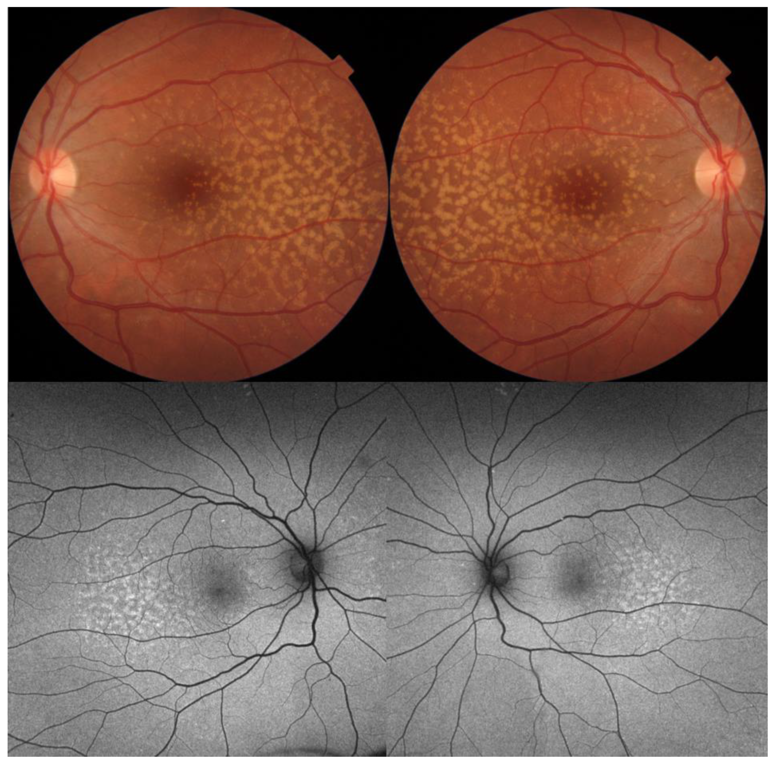 Diagnostics 14 00878 g009