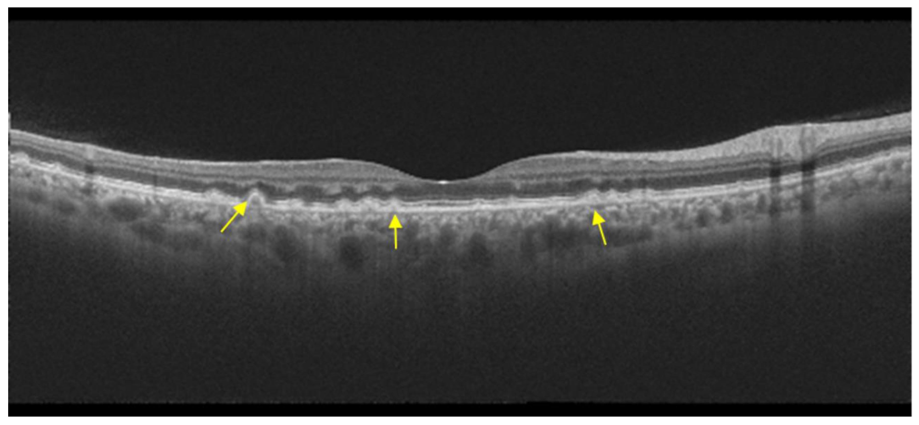 Diagnostics 14 00878 g010