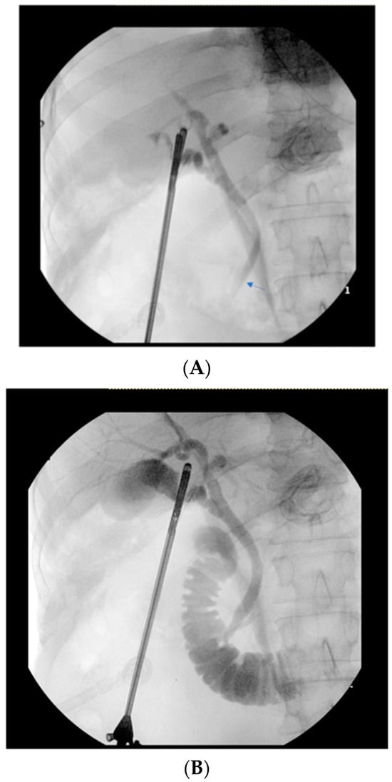 Diagnostics Free Full Text The Impact Of Intraoperative Glucagon On