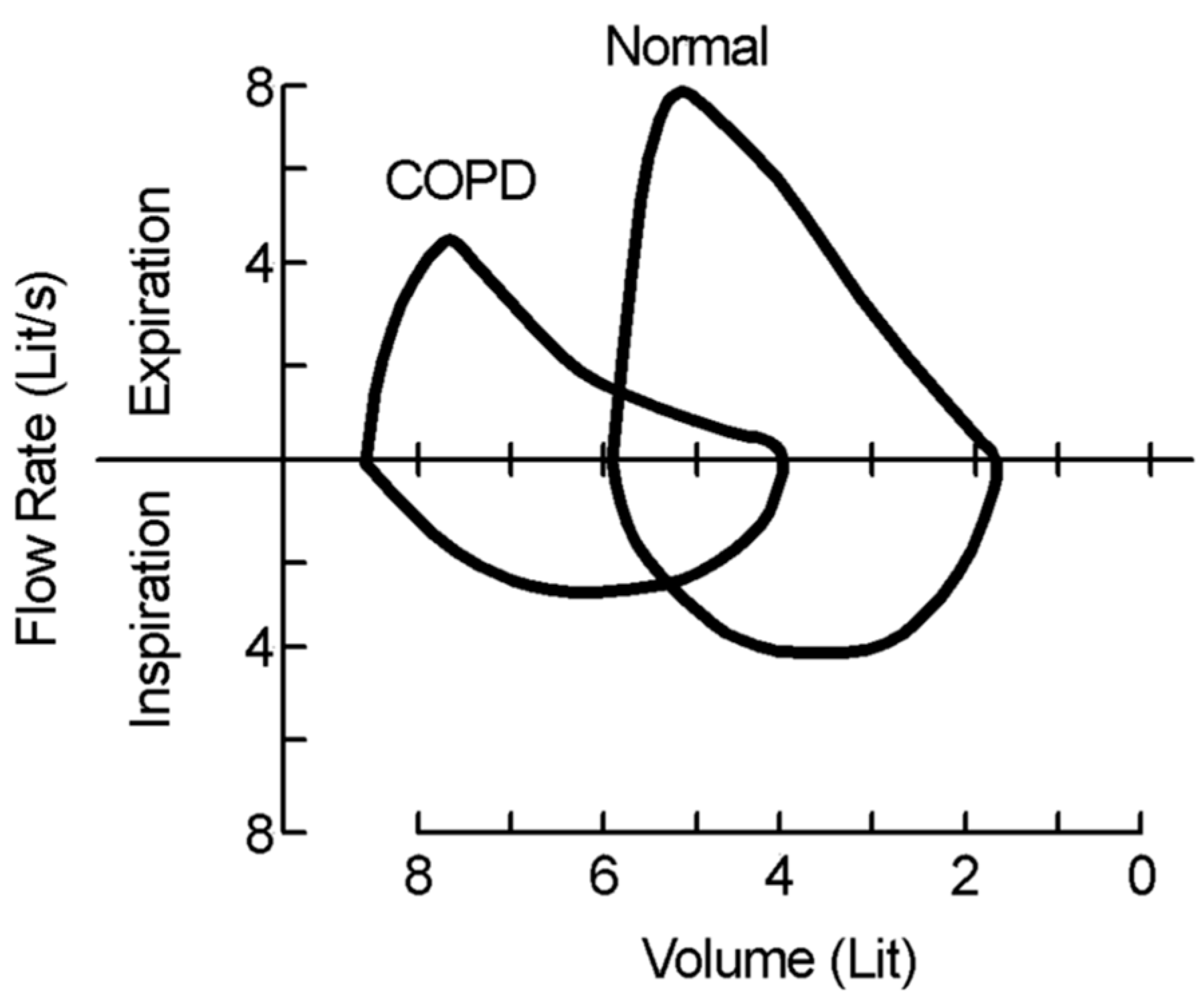 Electronics 09 00275 g013