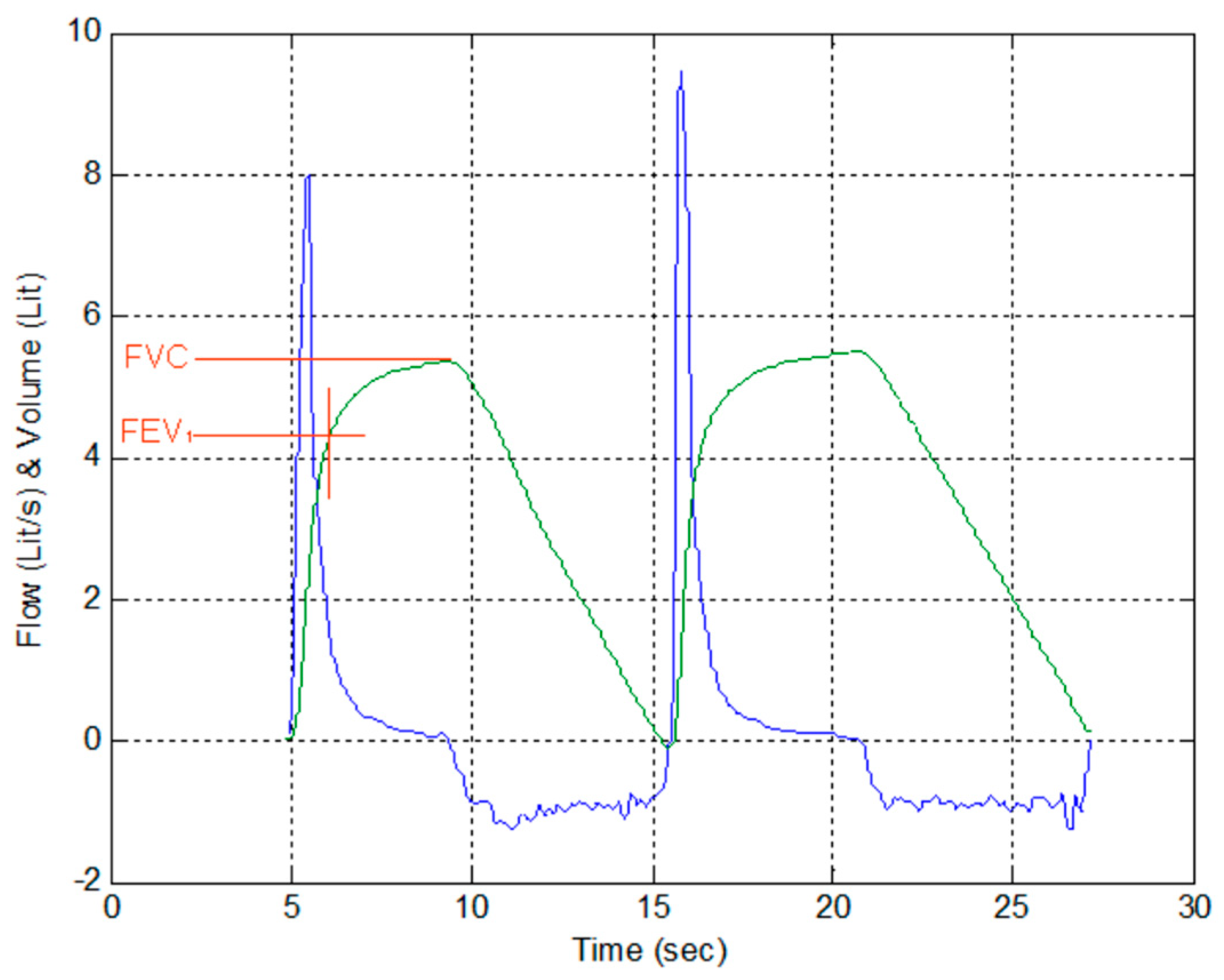 Electronics 09 00275 g014