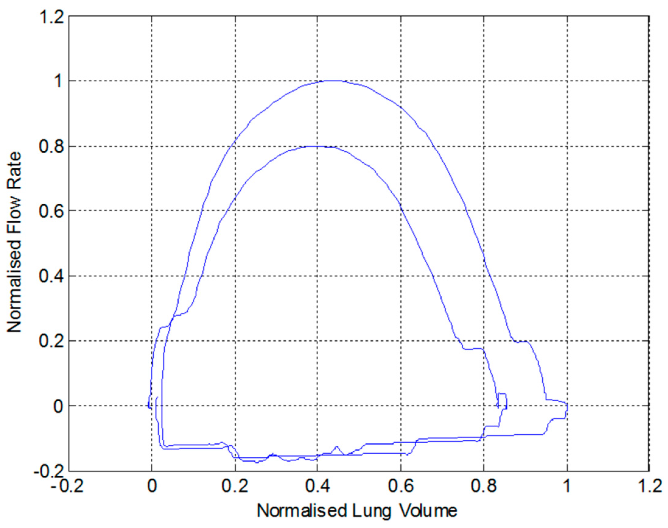 Electronics 09 00275 g021