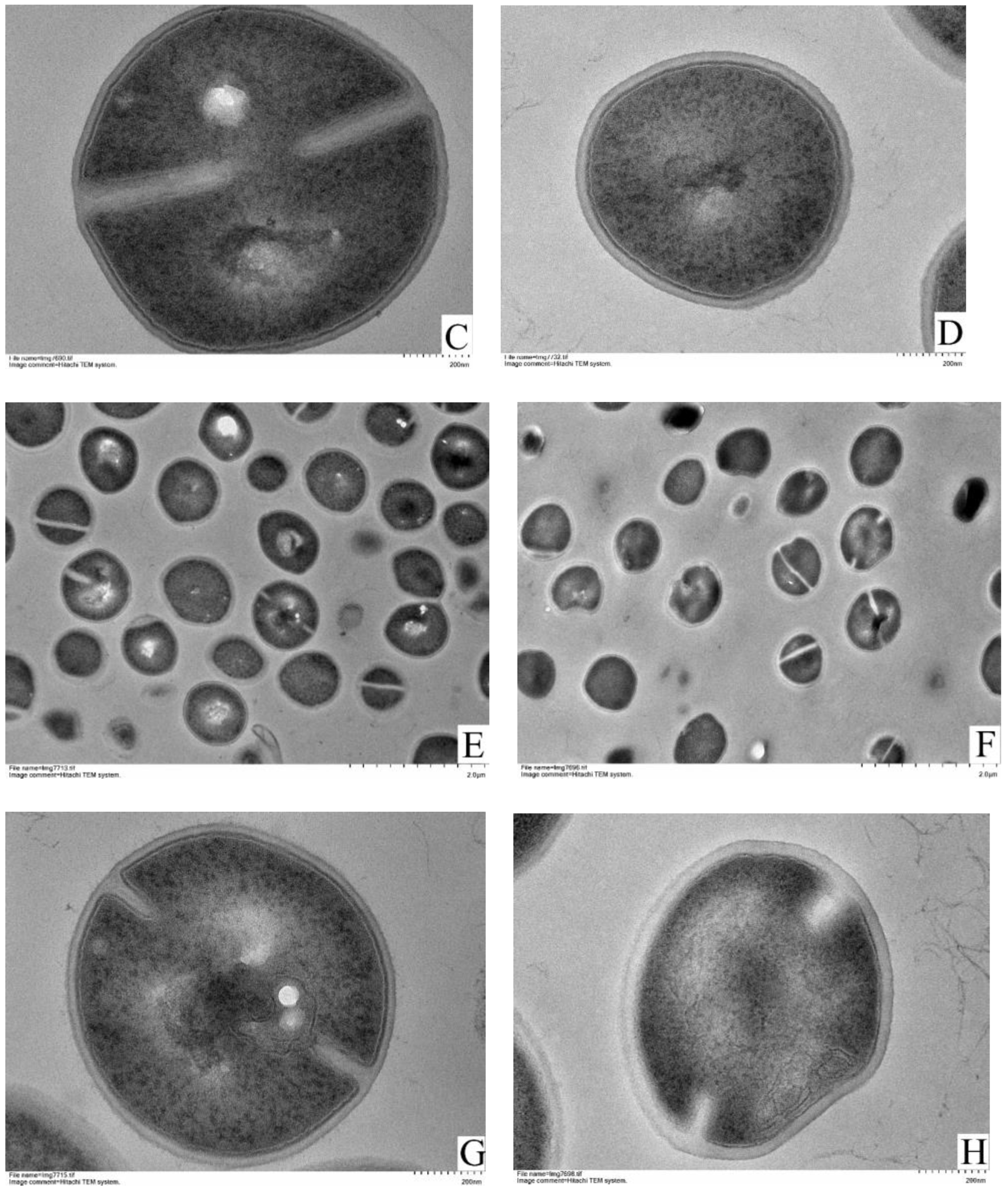 Foods 11 00996 g004b