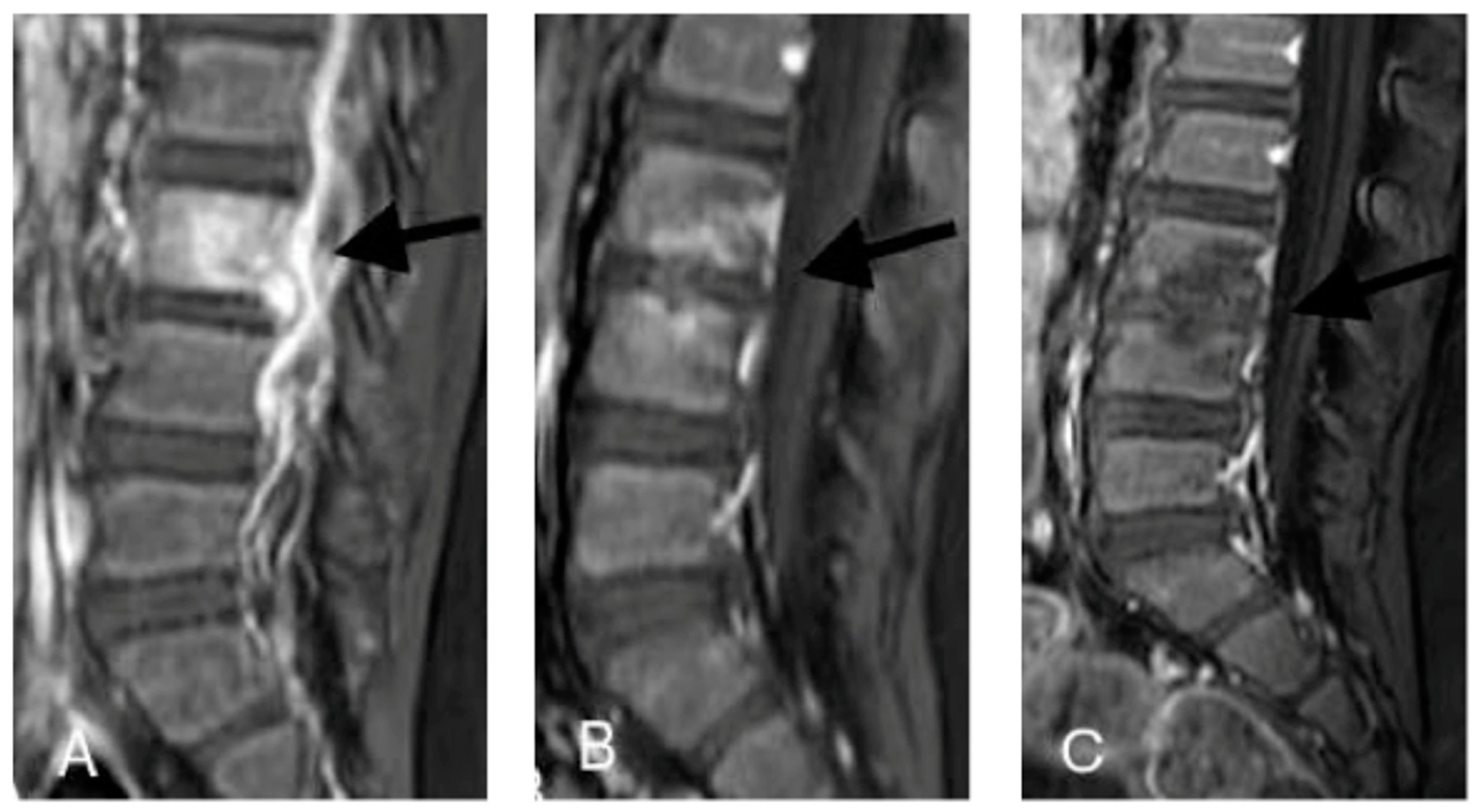 Ijerph 15 01195 g002 Ijerph 15 01195 g002