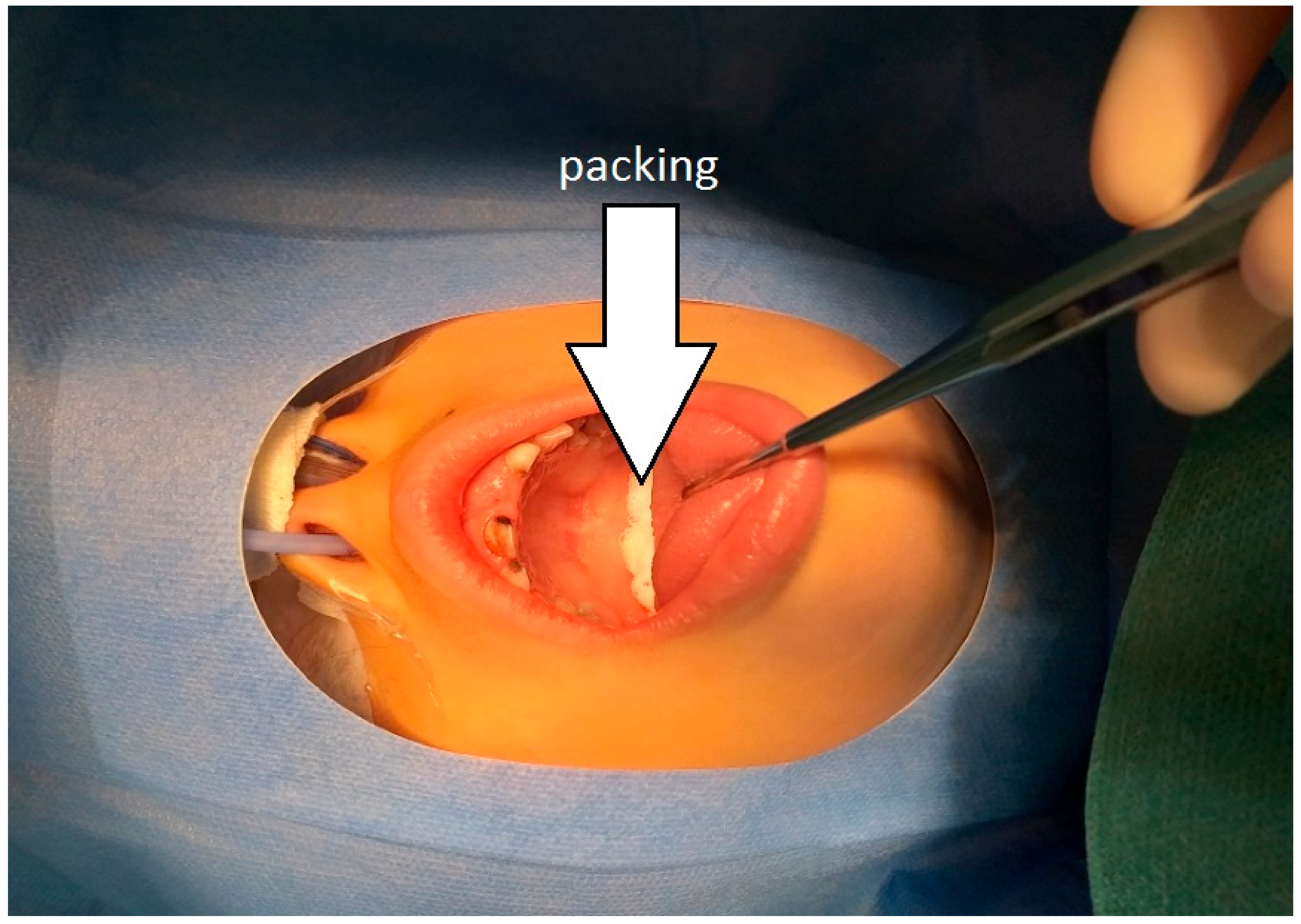 Ijerph 17 01603 g002 Ijerph 17 01603 g002