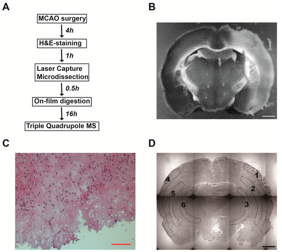 Identification of Site-Specific Stroke Biomarker Candidates by Laser Capture Microdissection and Labeled Reference Peptide Identification of Site-Specific Stroke Biomarker Candidates by Laser Capture Microdissection and Labeled Reference Peptide
