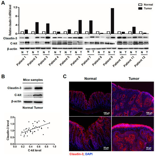 SCF-C-Kit-JNK-AP-1 Signaling Pathway Promotes Claudin-3 Expression in Colonic Epithelium and Colorectal Carcinoma SCF-C-Kit-JNK-AP-1 Signaling Pathway Promotes Claudin-3 Expression in Colonic Epithelium and Colorectal Carcinoma