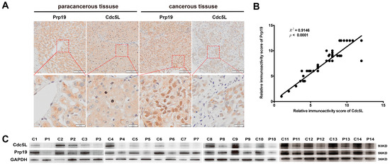 Prp19 Arrests Cell Cycle via Cdc5L in Hepatocellular Carcinoma Cells Prp19 Arrests Cell Cycle via Cdc5L in Hepatocellular Carcinoma Cells