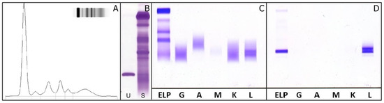 Analytical Criticalities Associated to Different Immunological Methods for Serum Free Light Chain Detection in Plasma Cell Dyscrasias: A Description of Particular Clinical Cases Analytical Criticalities Associated to Different Immunological Methods for Serum Free Light Chain Detection in Plasma Cell Dyscrasias: A Description of Particular Clinical Cases