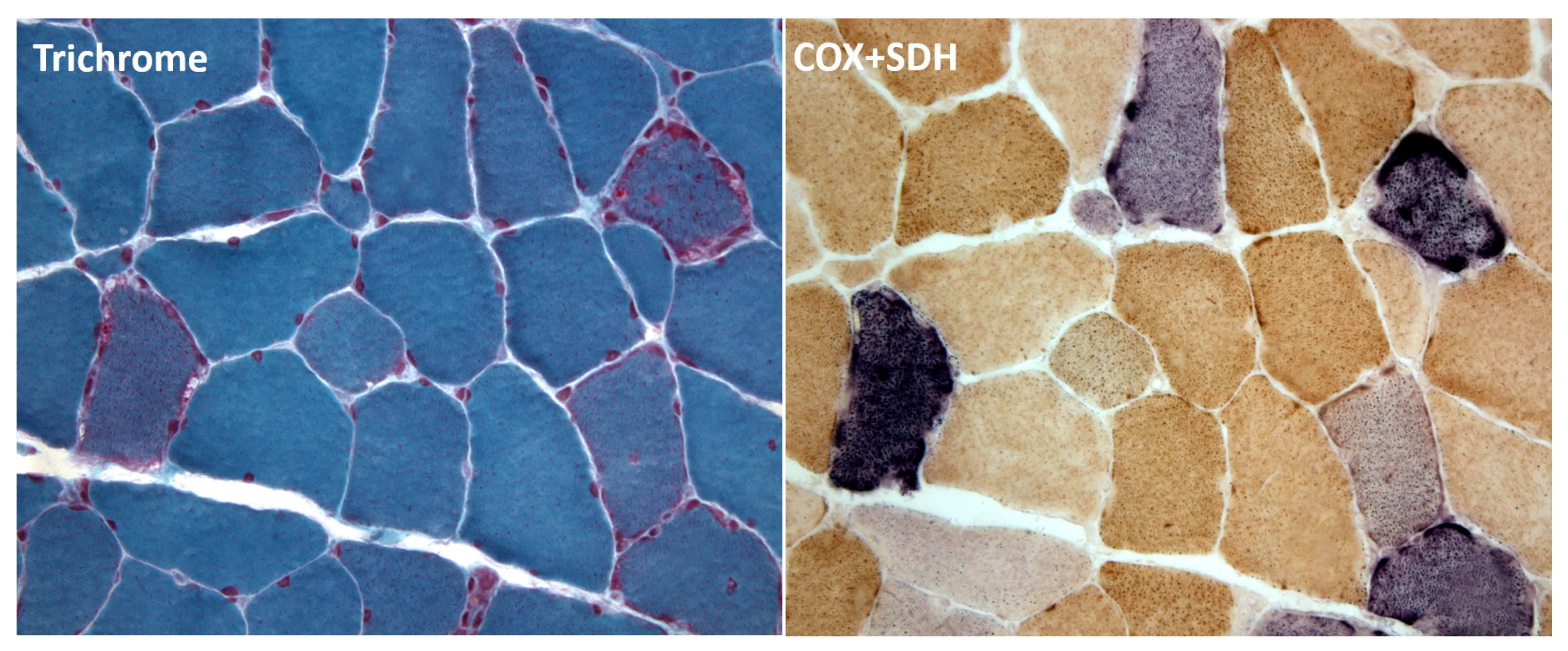 Ijms 20 05643 g002 Ijms 20 05643 g002