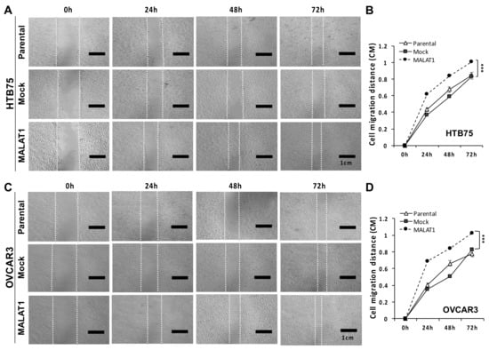 Ijms Free Full Text Lncrna Malat Facilitates Ovarian Cancer