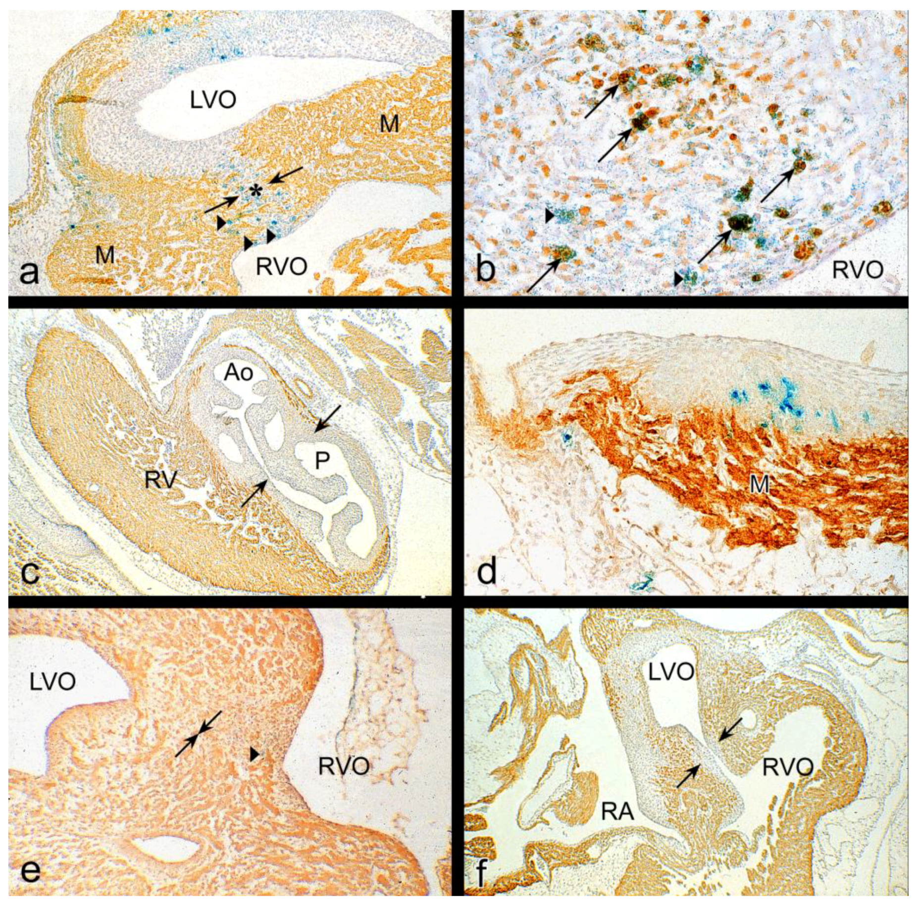 Jcdd 05 00054 g004 Jcdd 05 00054 g004