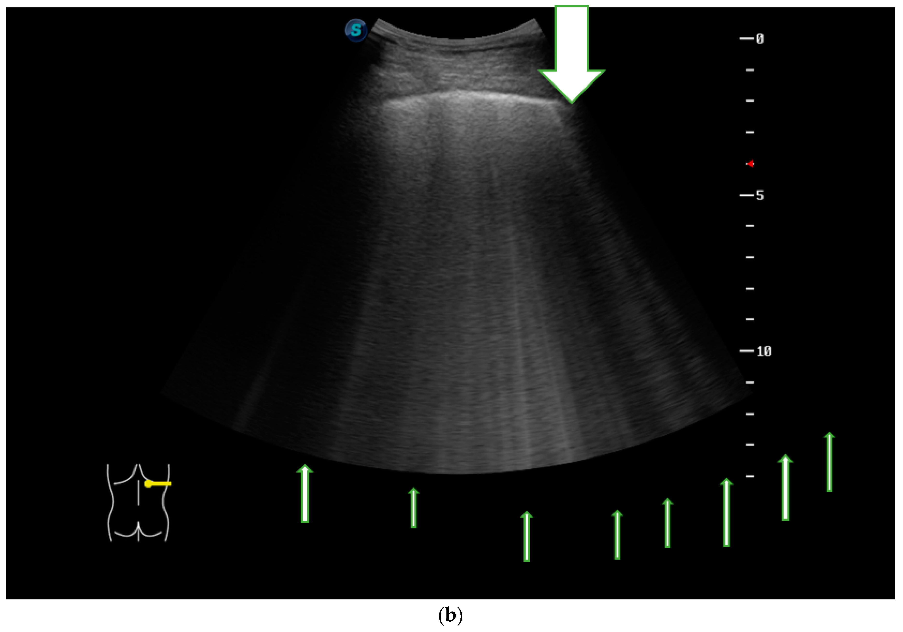 Jcm 08 01199 g003b Jcm 08 01199 g003b