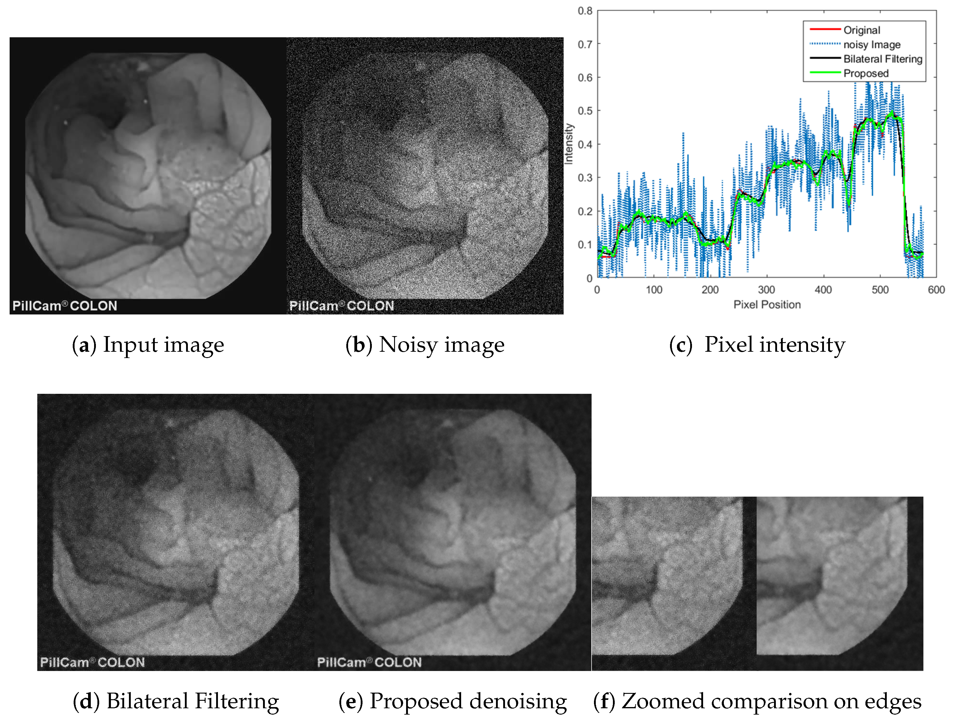 Jimaging 04 00075 g011 Jimaging 04 00075 g011