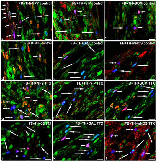 The Influence of Tetrodotoxin TTX on the Distribution and Chemical Coding of Caudal Mesenteric Ganglion CaMG Neurons Supplying the Porcine Urinary Bladder The Influence of Tetrodotoxin TTX on the Distribution and Chemical Coding of Caudal Mesenteric Ganglion CaMG Neurons Supplying the Porcine Urinary Bladder