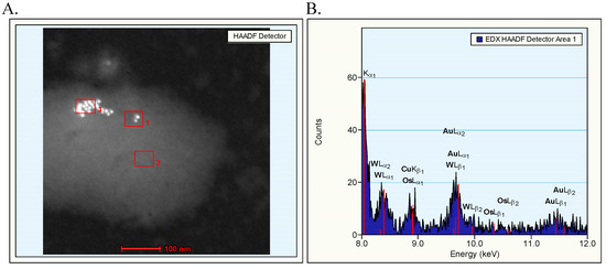 Detection of the Presence of Gold Nanoparticles in Organs by Transmission Electron Microscopy Detection of the Presence of Gold Nanoparticles in Organs by Transmission Electron Microscopy