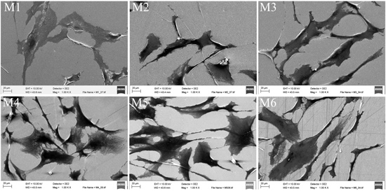 Behavior of Human Bone Marrow-Derived Mesenchymal Stem Cells on Various Titanium-Based Coatings Behavior of Human Bone Marrow-Derived Mesenchymal Stem Cells on Various Titanium-Based Coatings