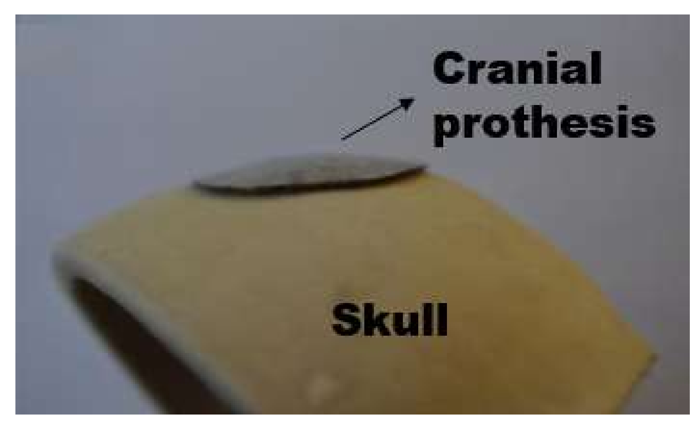 Materials 11 01262 g006