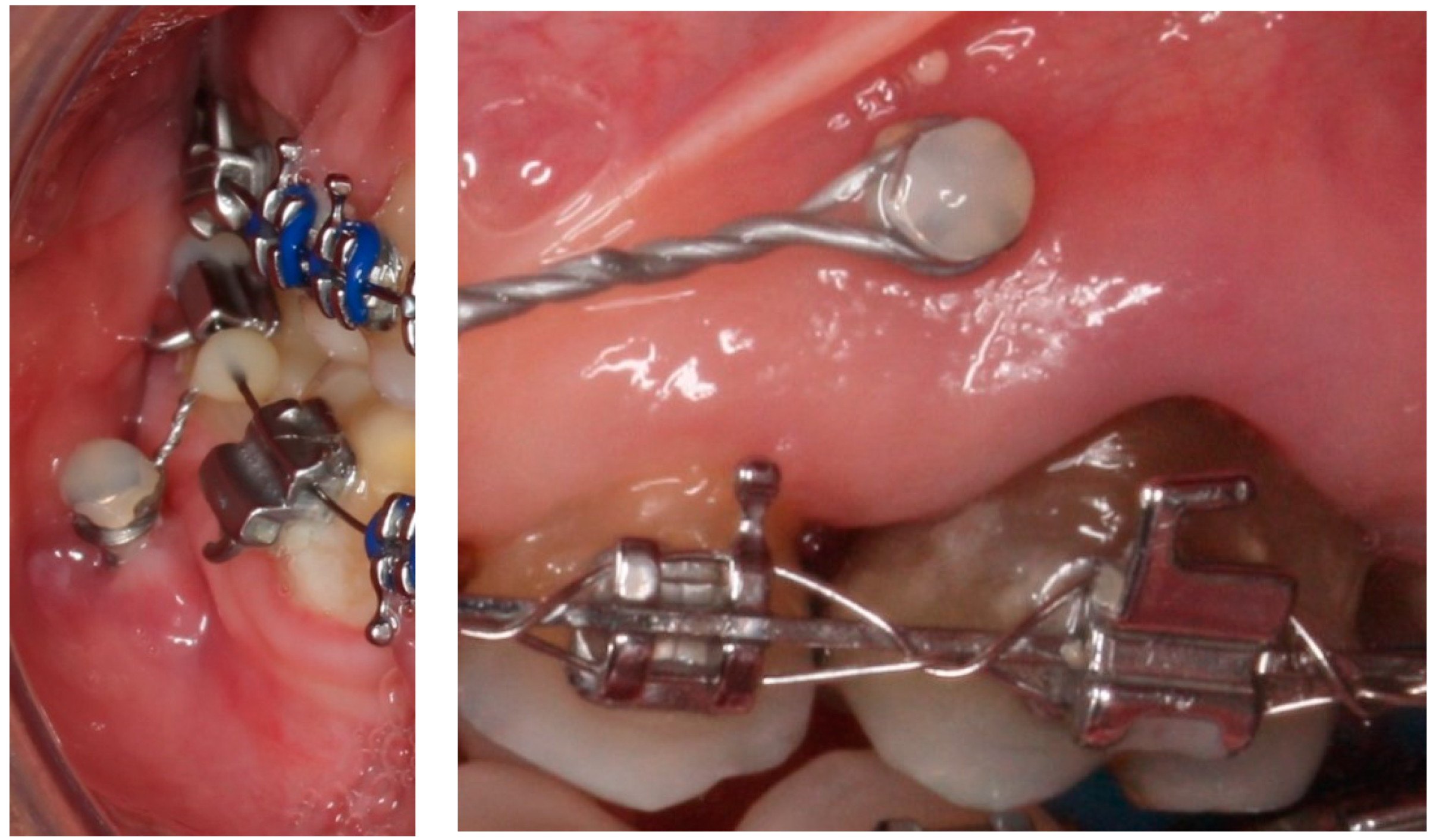 Materials 15 07487 g002