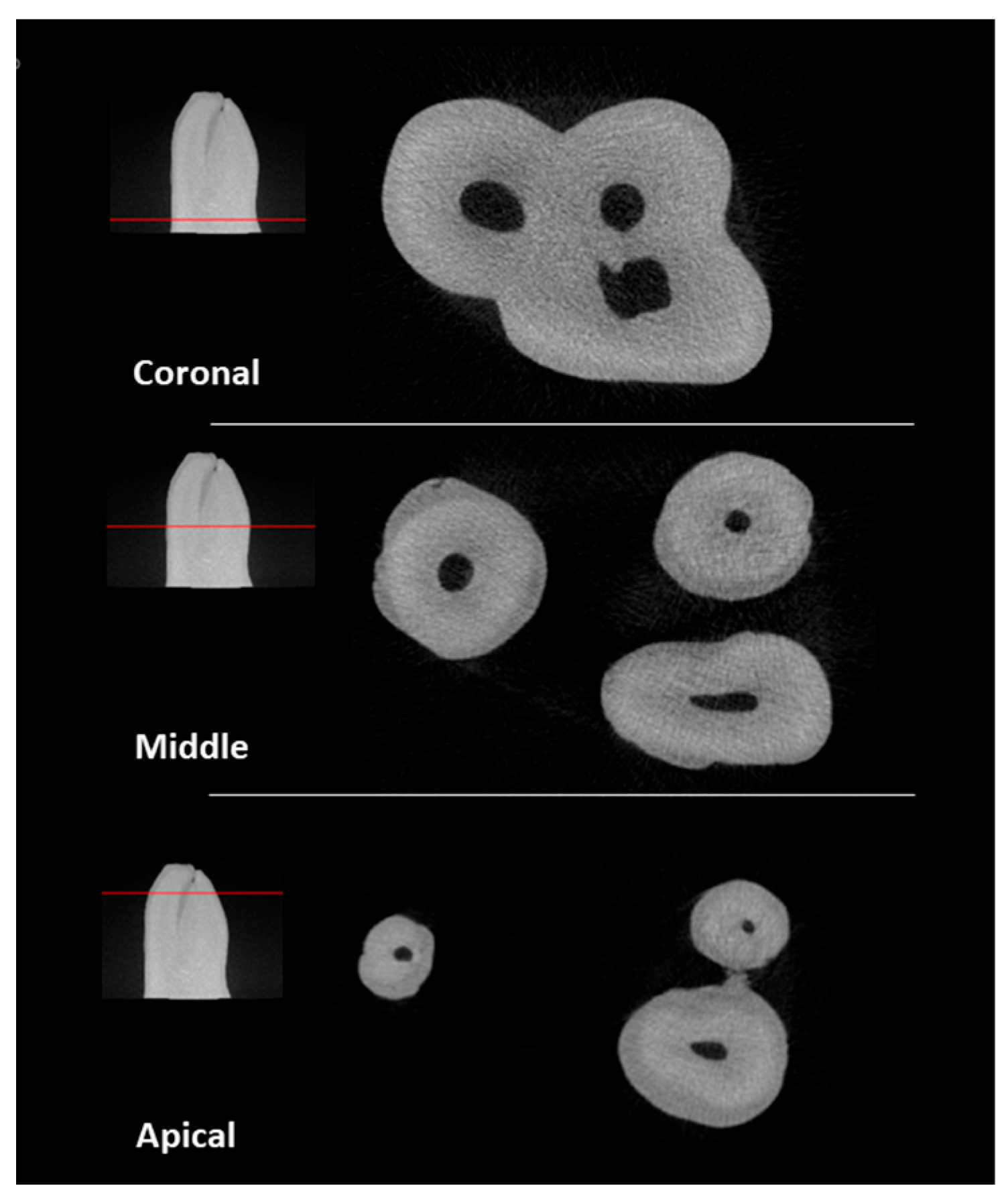 Materials 17 01899 g001