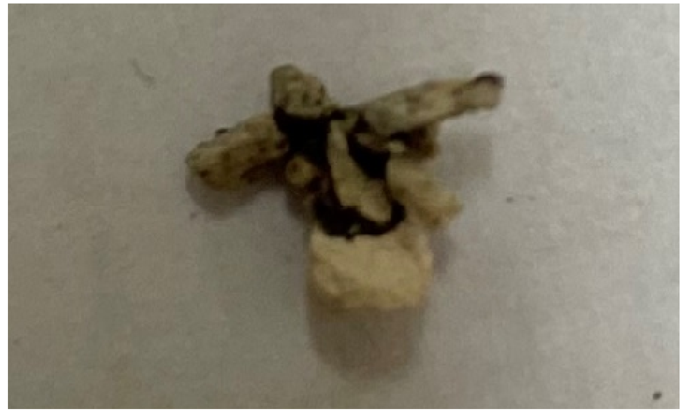 Materials 17 02185 g009