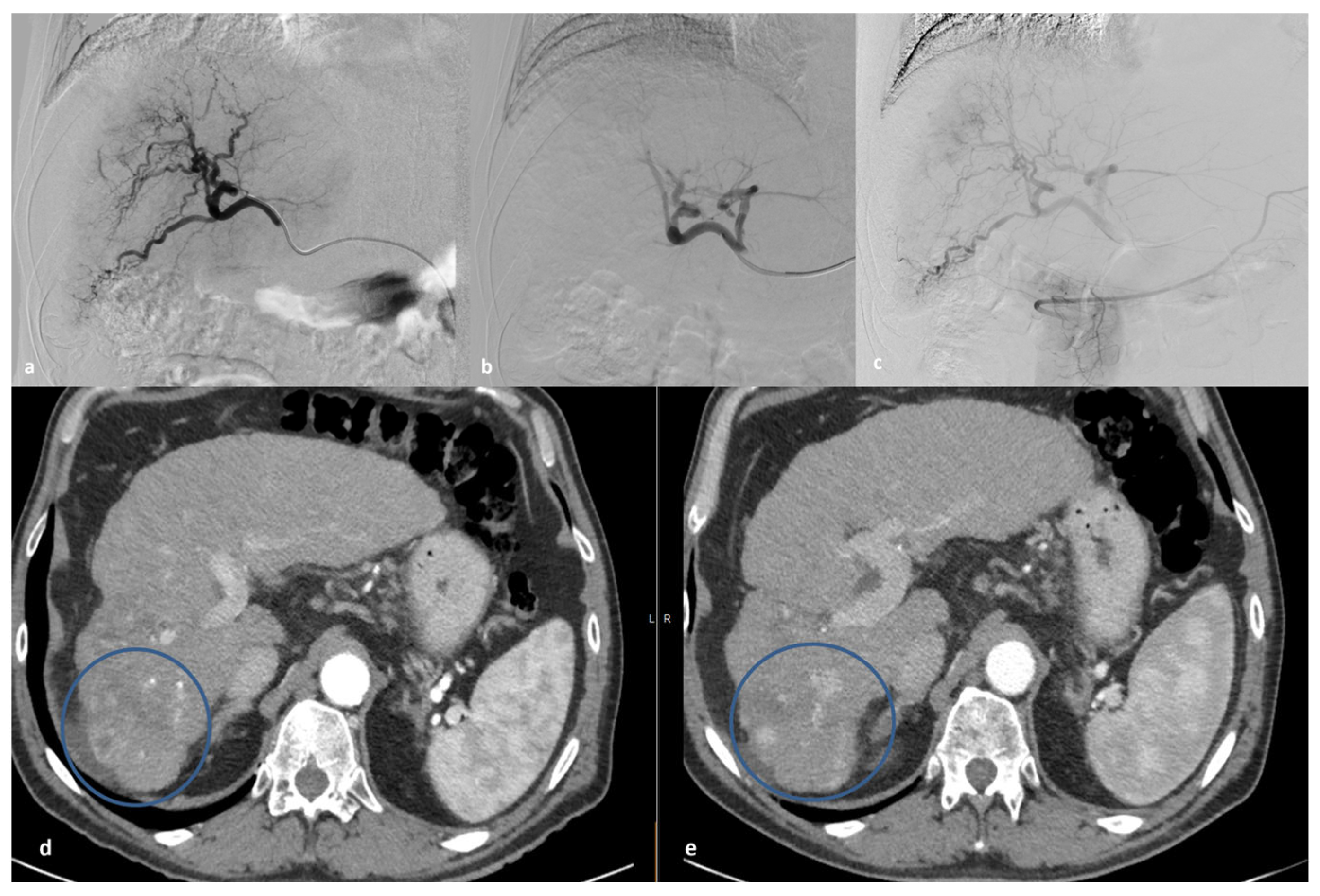 Medicina 60 00678 g001