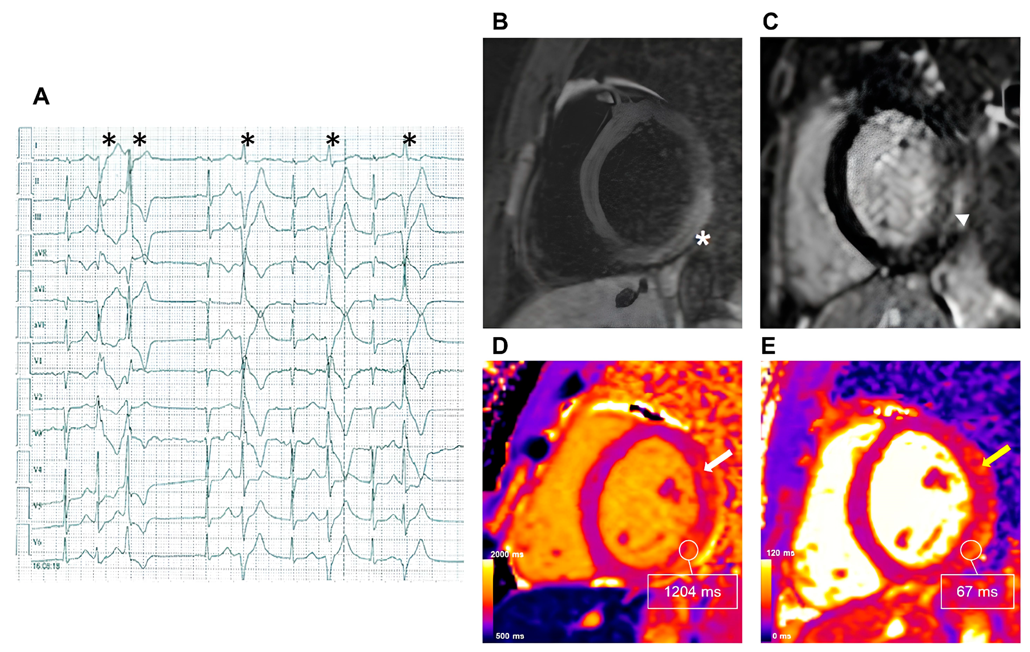Medicina 60 00691 g002