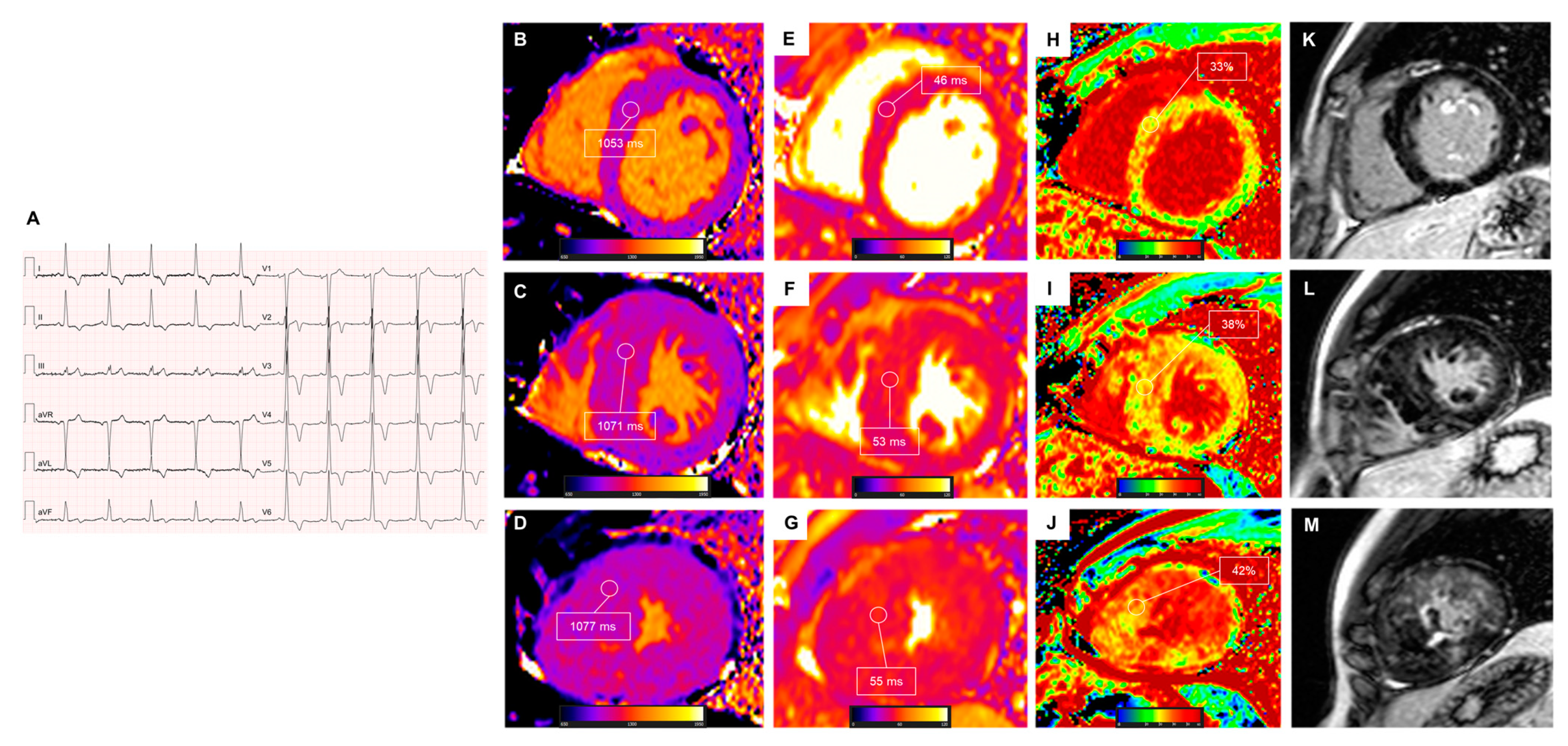 Medicina 60 00691 g003